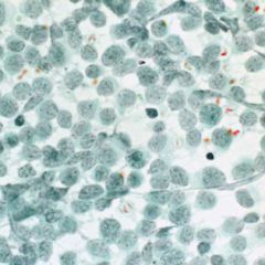 MerkelzellPolyomavirus DocCheck Flexikon