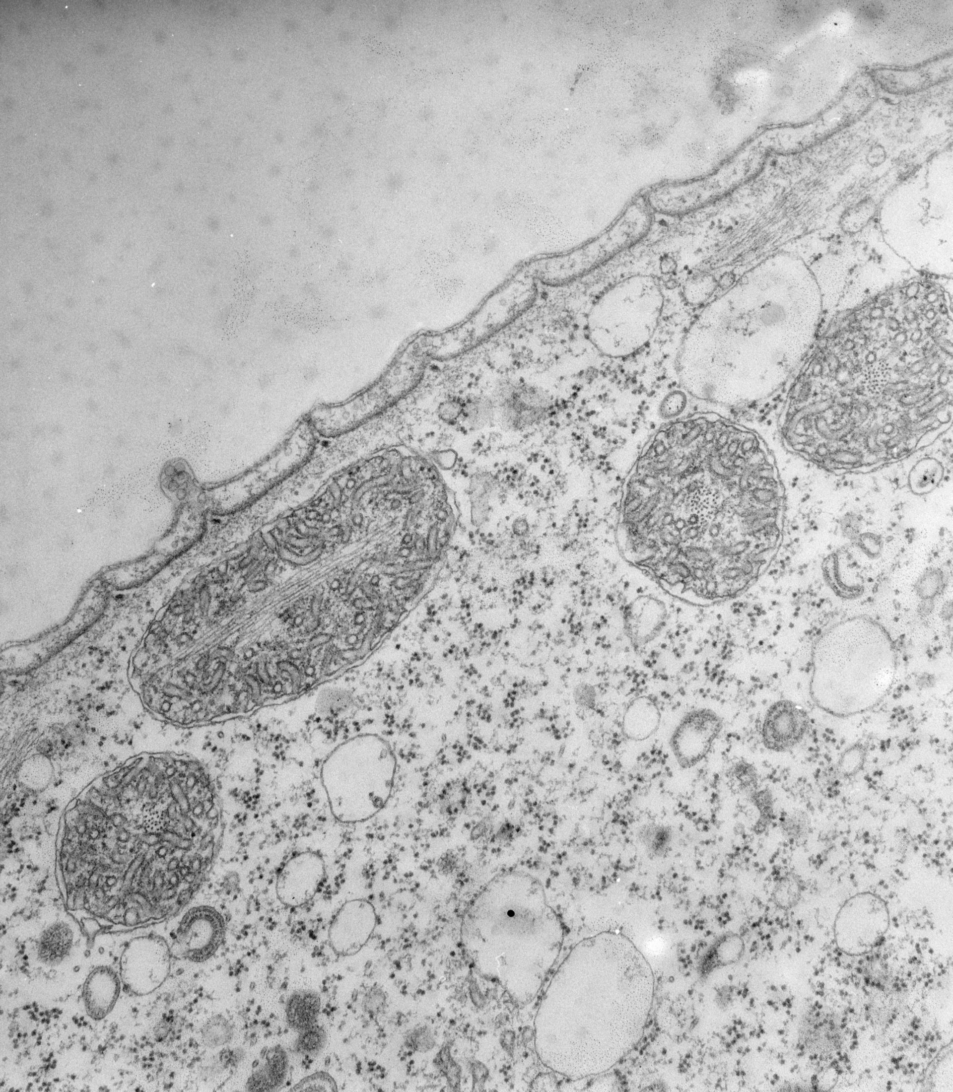 Vorticella convallaria (Mitochondrial chromosome) - CIL:39451