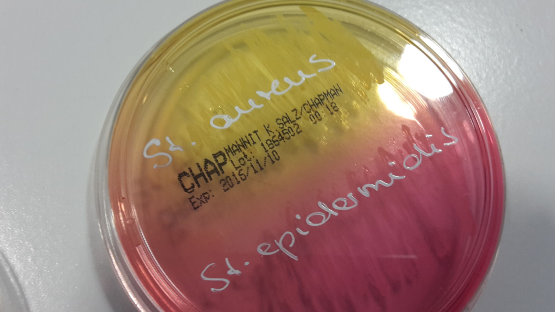 Staphylococcus aureus und Staphylococcus epidermidis auf Mannitol-Kochsalz-Agar