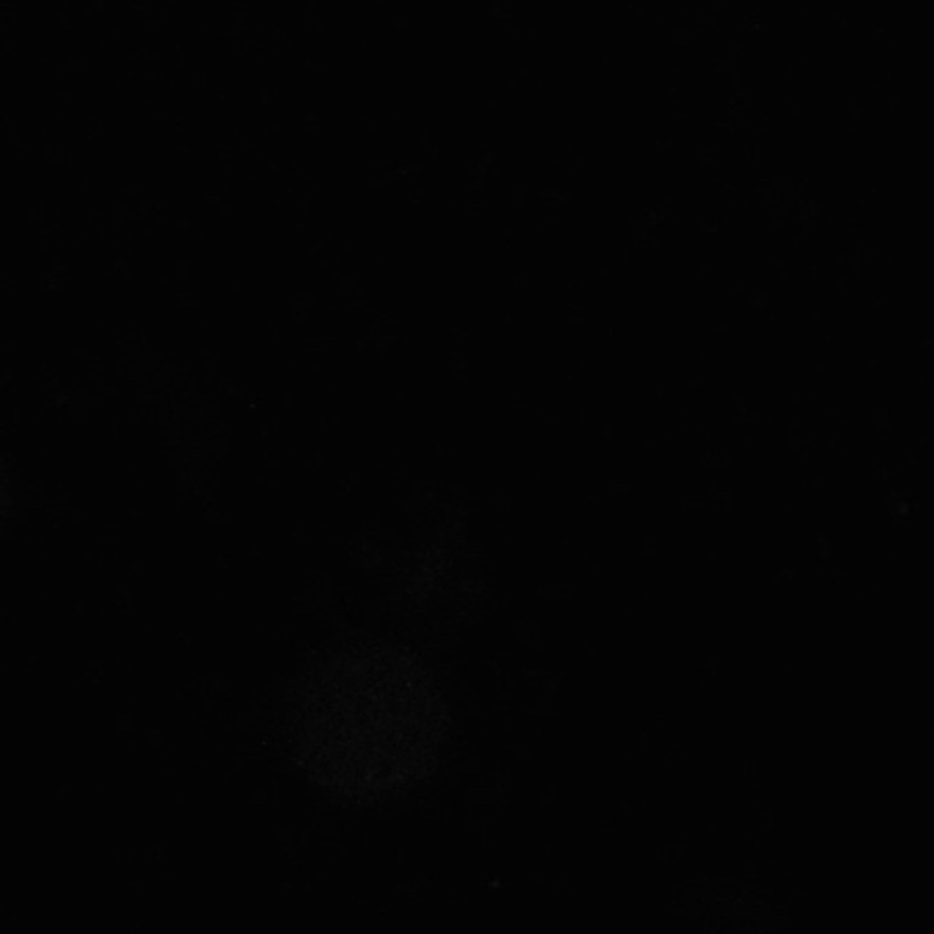 Xenopus laevis (Neuronal cell body) - CIL:36983