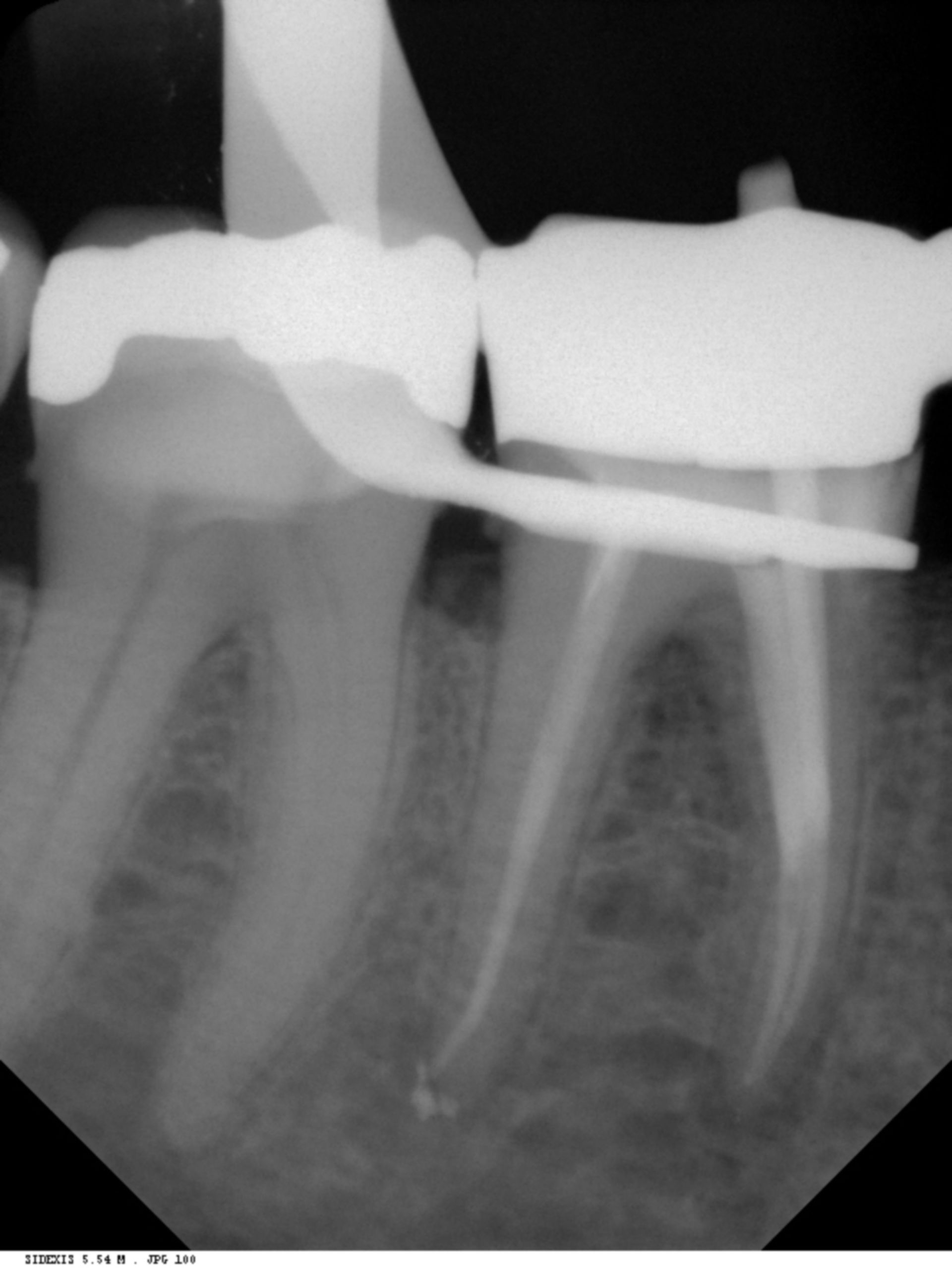 Röntgenbild: Zahn