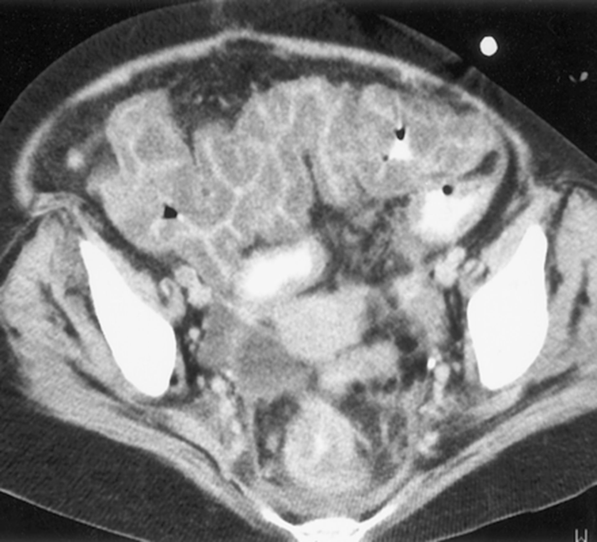 Fall Des Tages: CT Abdomen - DocCheck