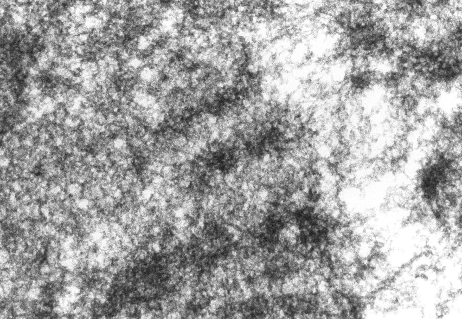 Drosophila melanogaster (Polytene chromosome) - CIL:25325