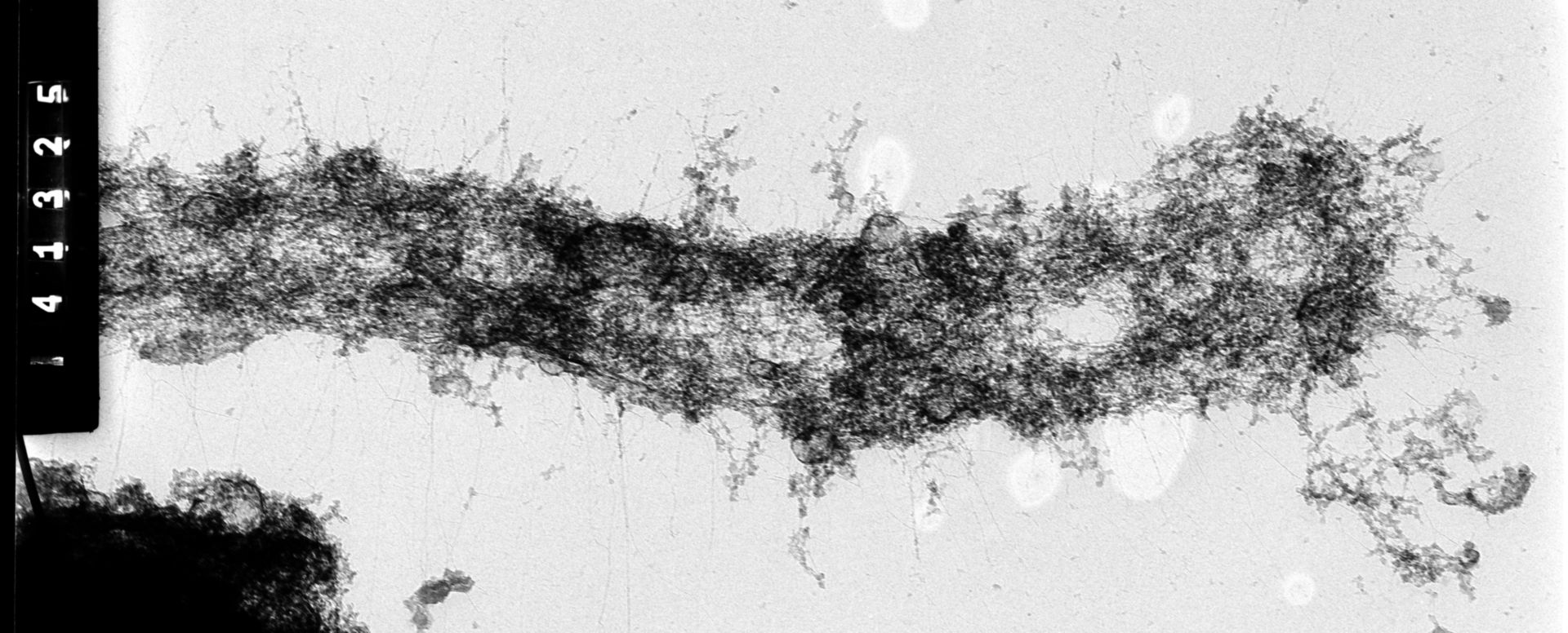 Homo sapiens (Condensed chromosome) - CIL:35376