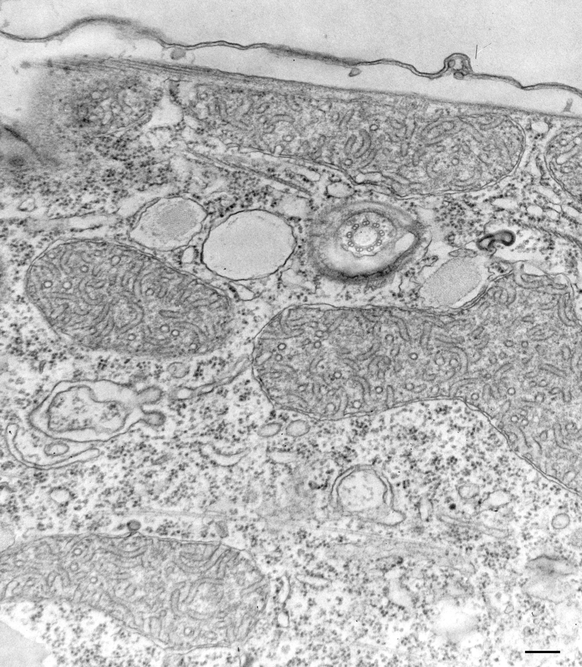 Tetrahymena pyriformis (Mitochondrial inner membrane) - CIL:36217