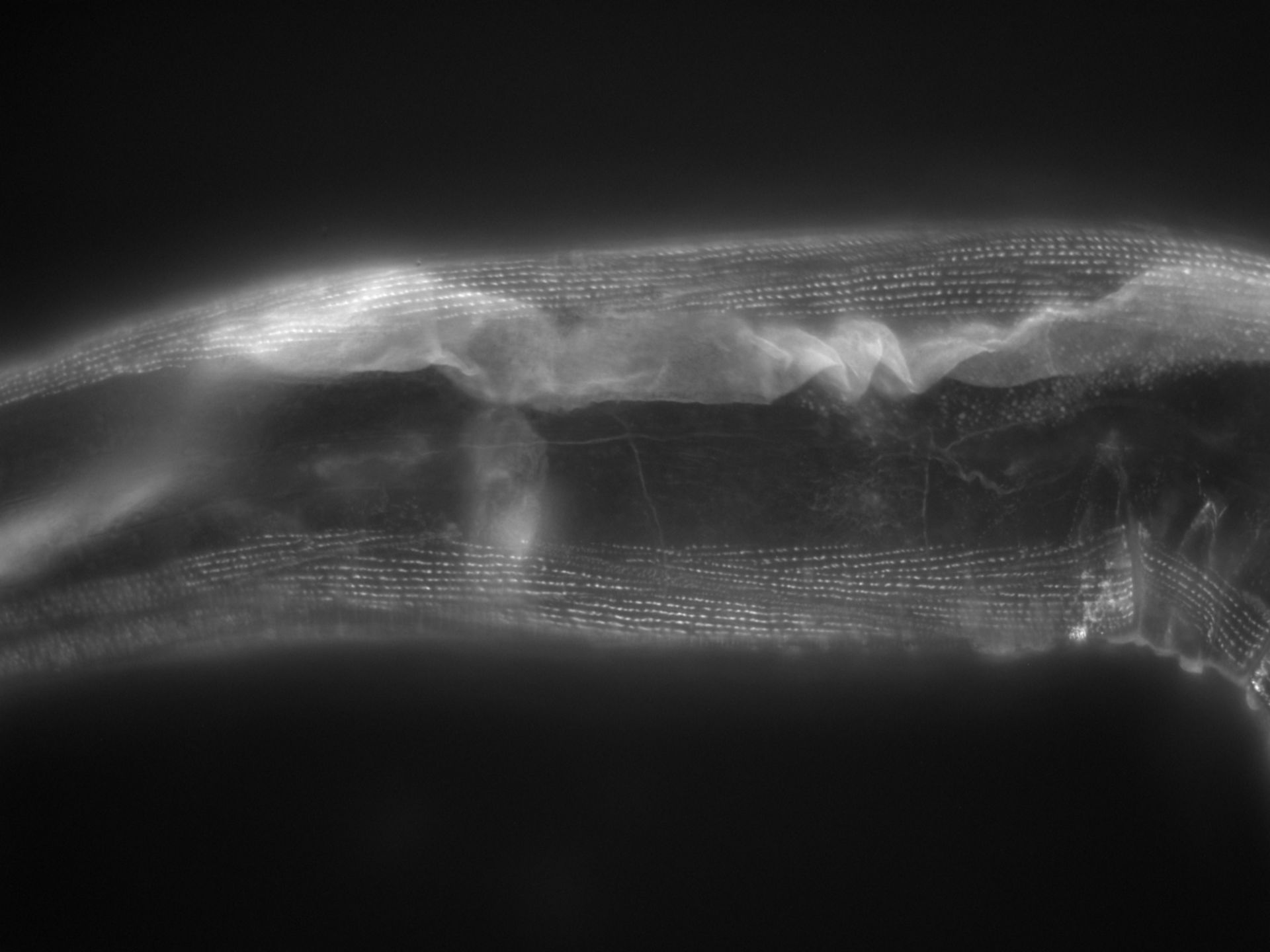 Caenorhabditis elegans (Actin filament) - CIL:1117