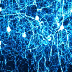 Willkürmotorik - DocCheck Flexikon