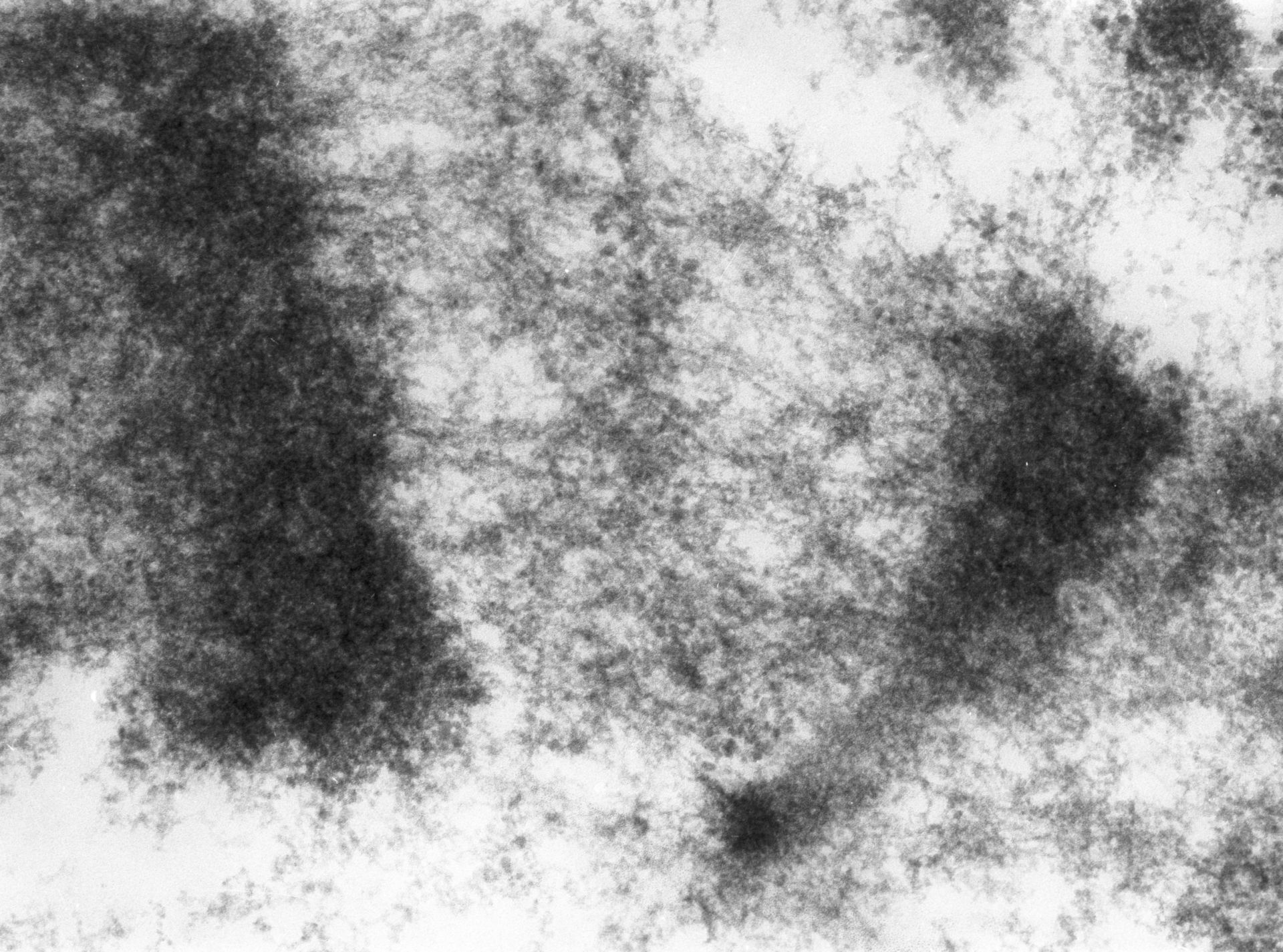 Drosophila melanogaster (Polytene chromosome) - CIL:24968