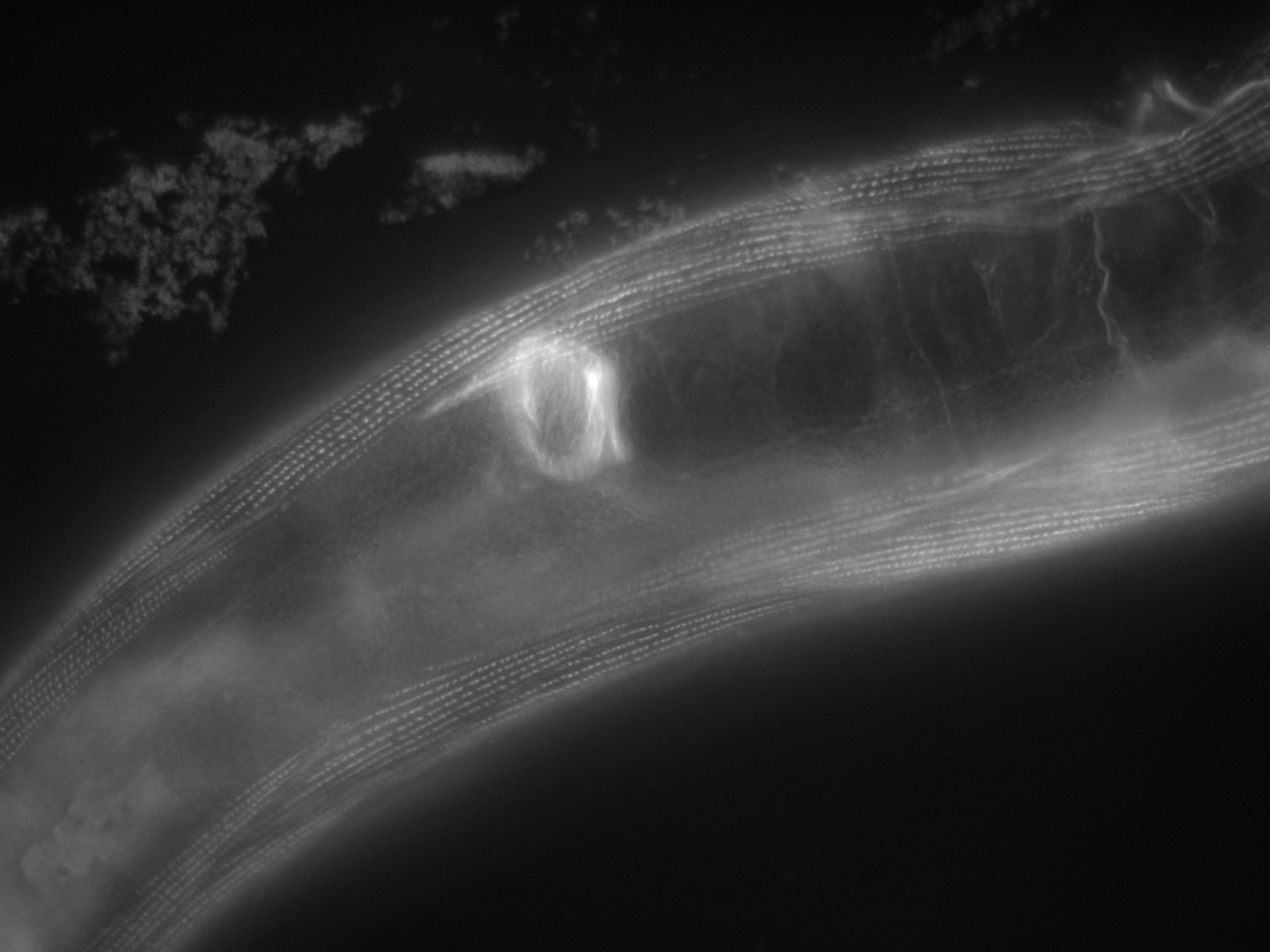 Caenorhabditis elegans (Actin filament) - CIL:1160