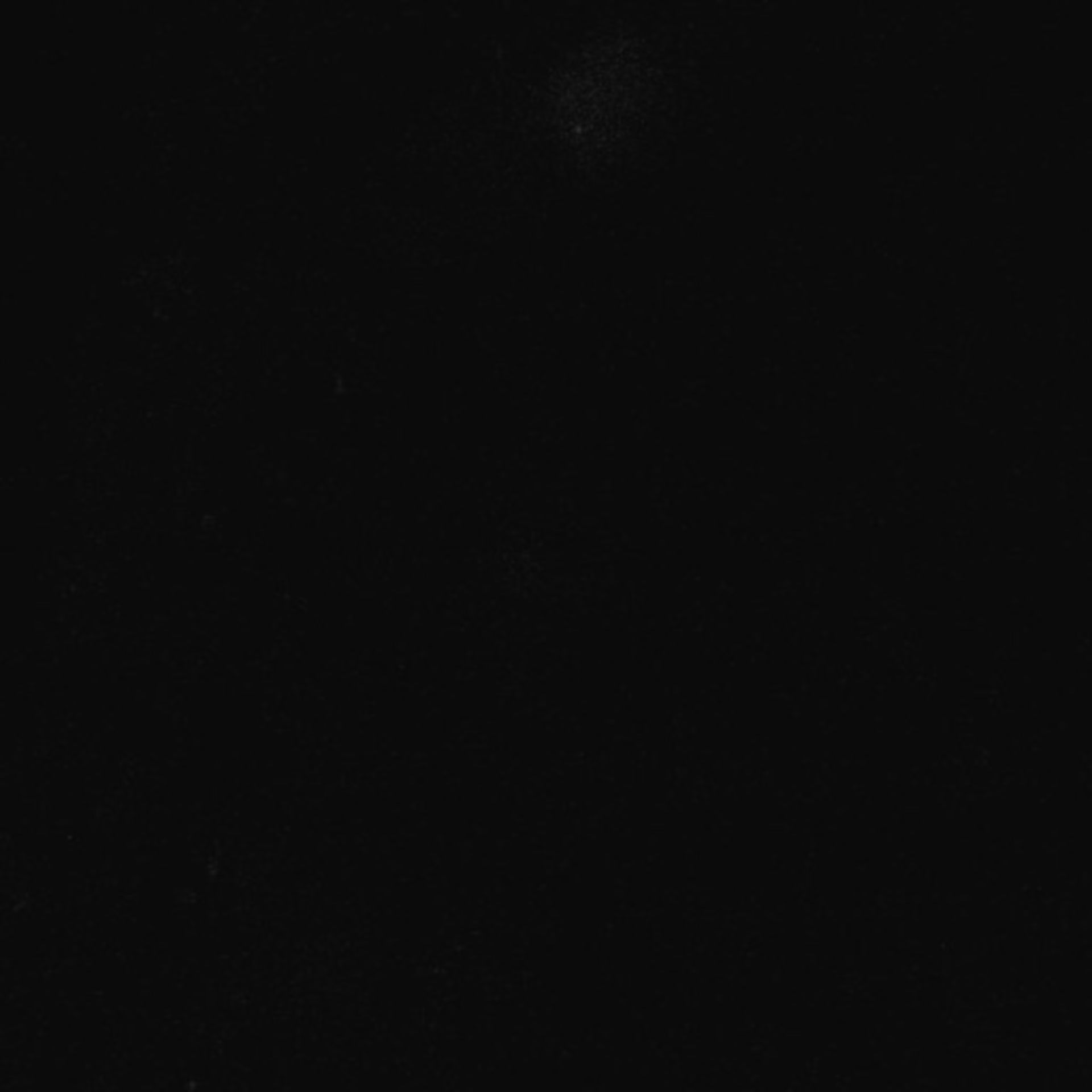 Xenopus laevis (Neuronal cell body) - CIL:36833