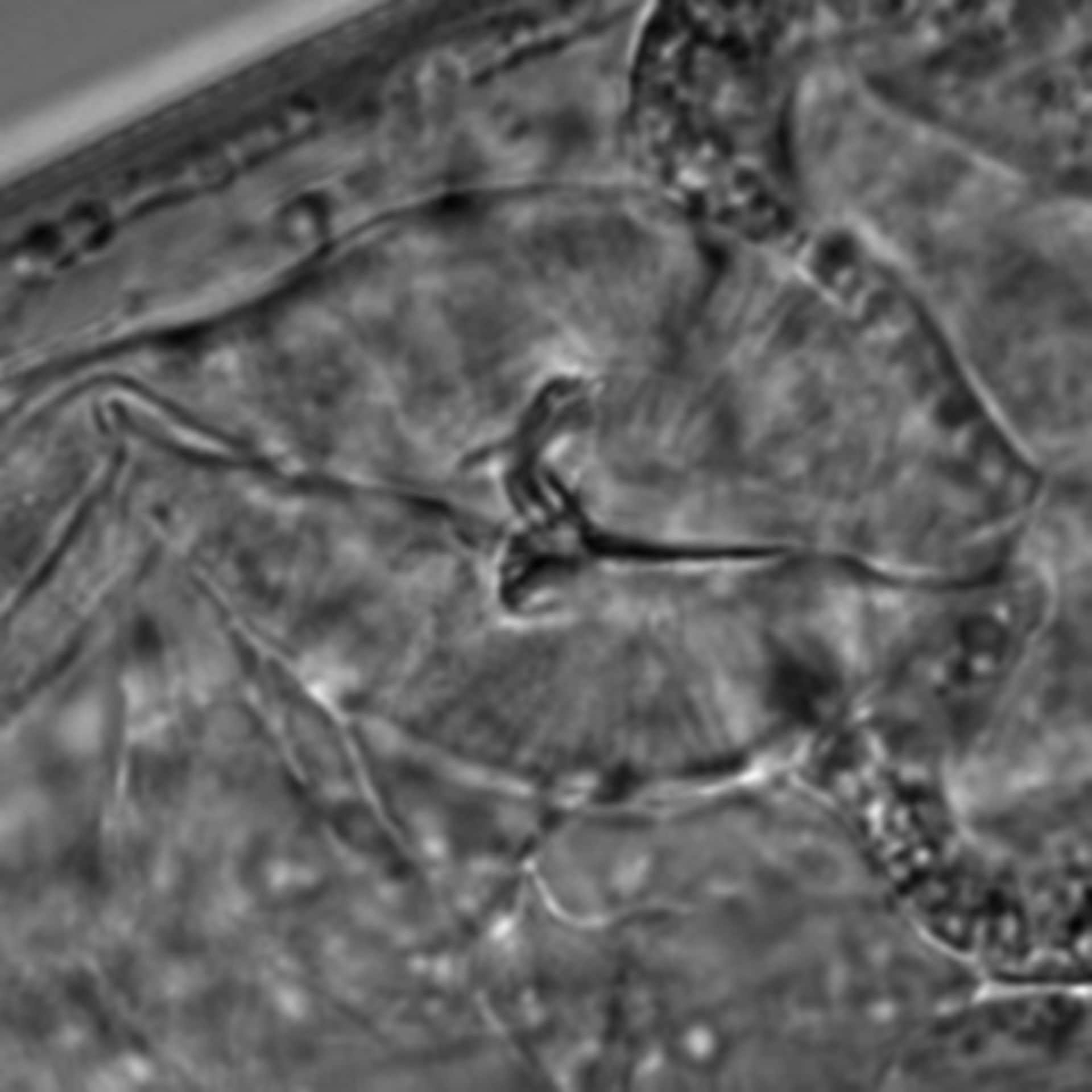 Caenorhabditis elegans - CIL:1634