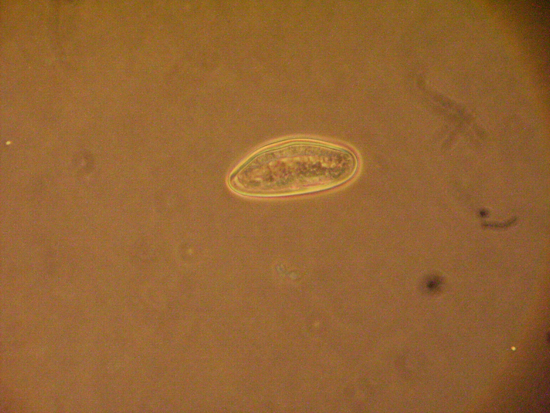 Enterobius vermicularis яйца под микроскопом