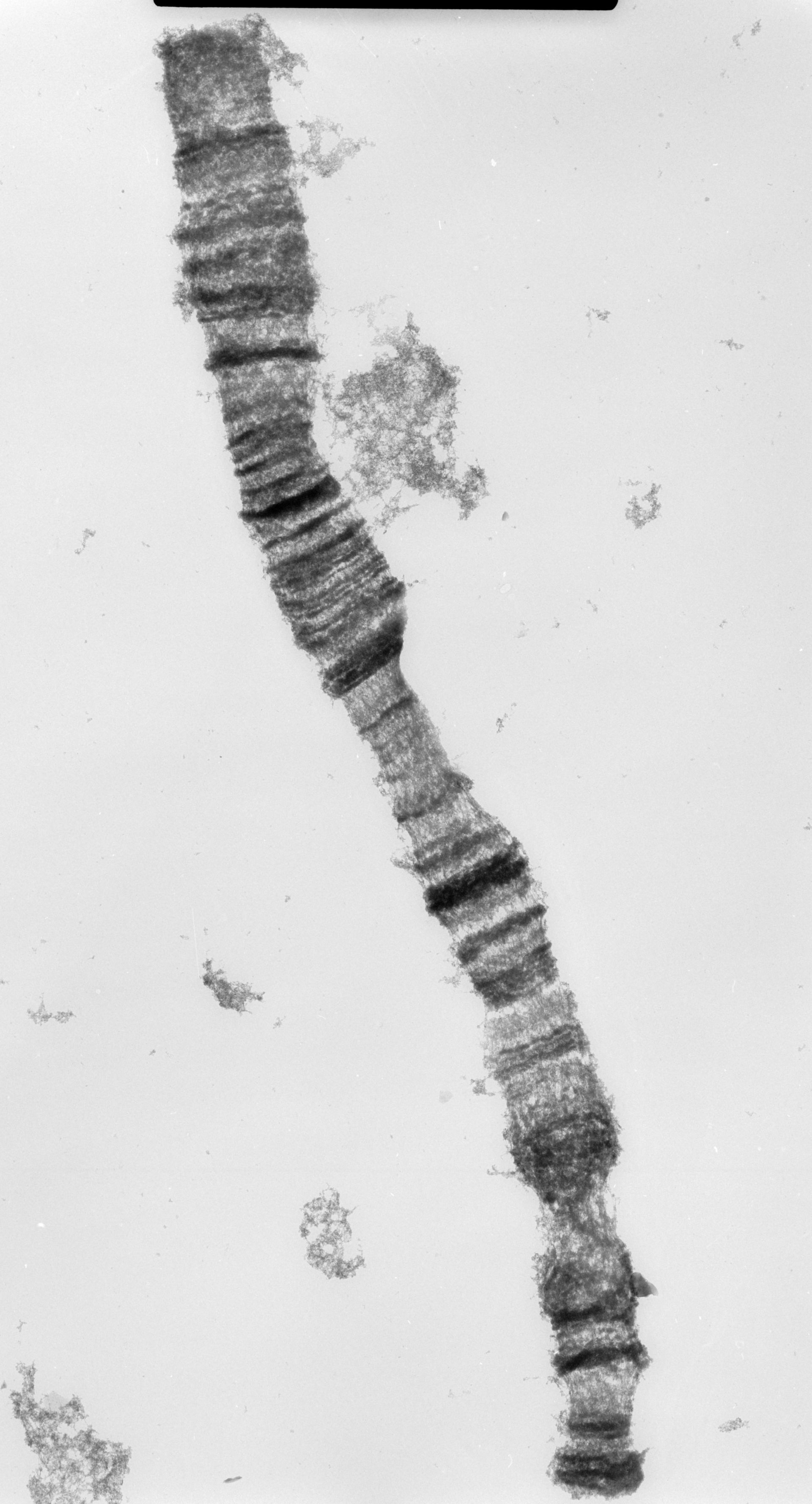 Drosophila melanocephala (Polytene chromosome) - CIL:35452