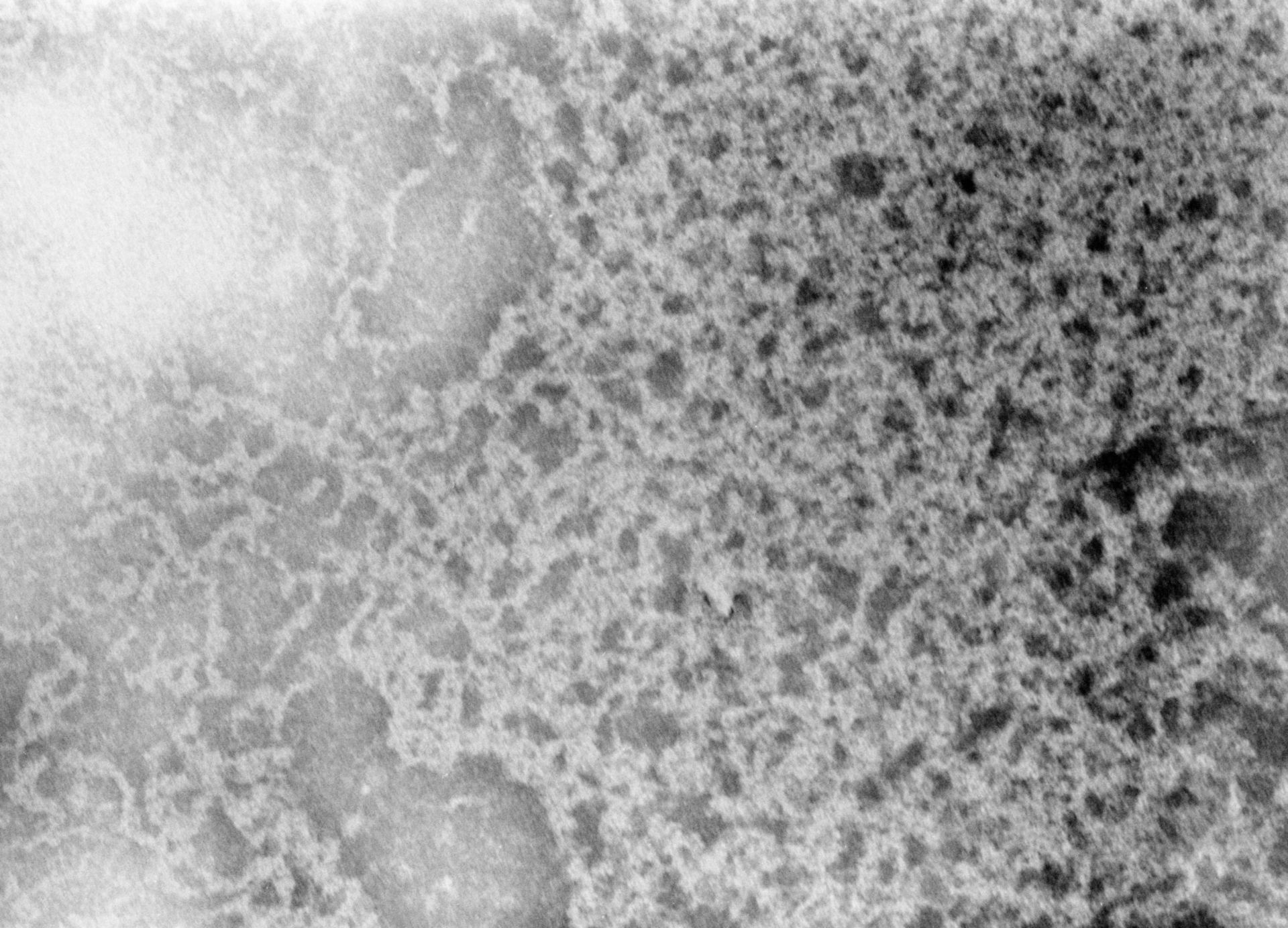 Notopthalmus viridescens (Nuclear chromatin) - CIL:9529