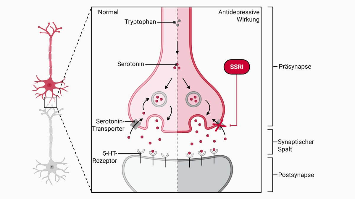 Serotonin-Wiederaufnahmehemmer (SSRI)