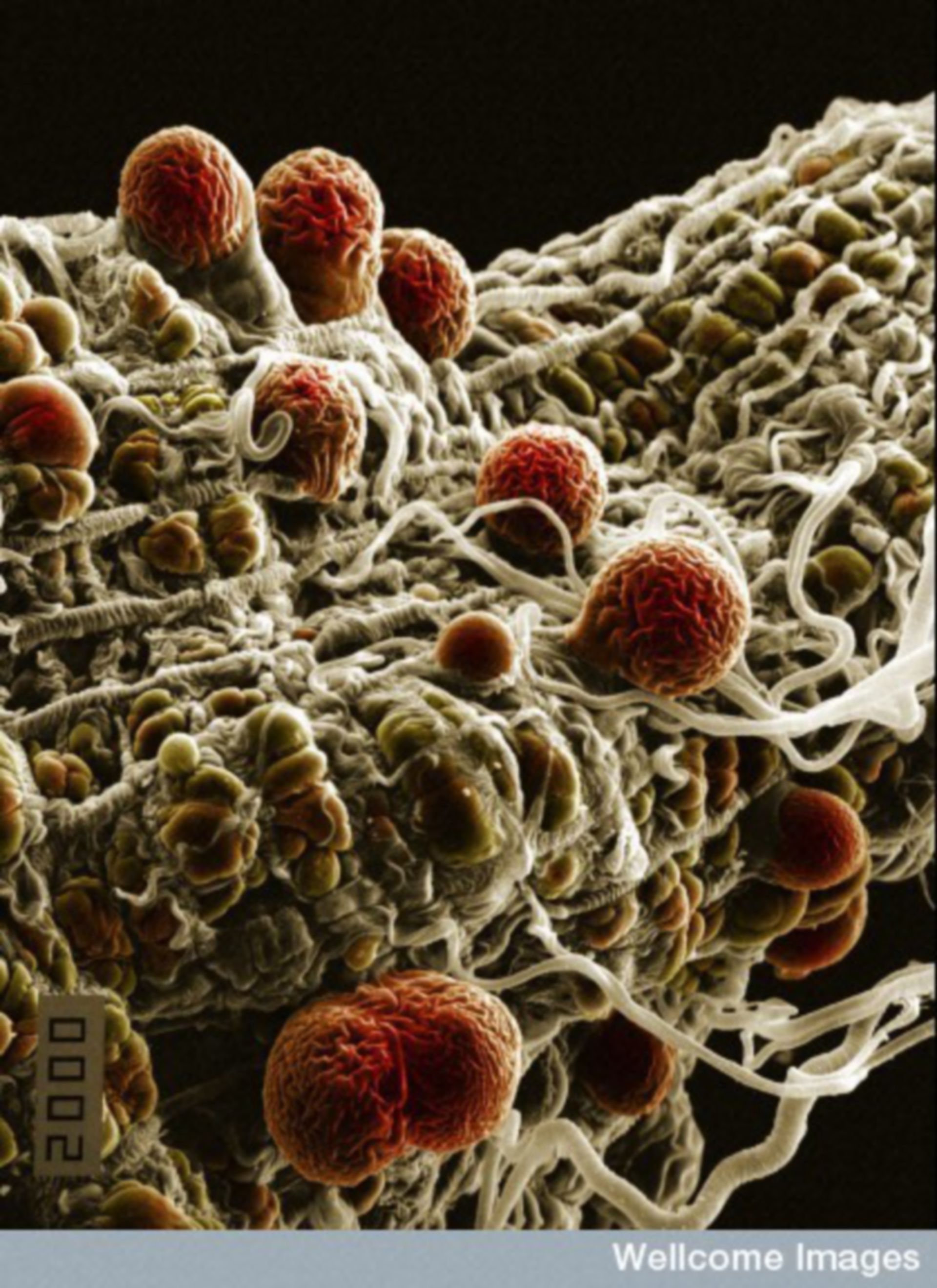 Malaria! Image of the Week - June 15, 2015 - CIL:39089