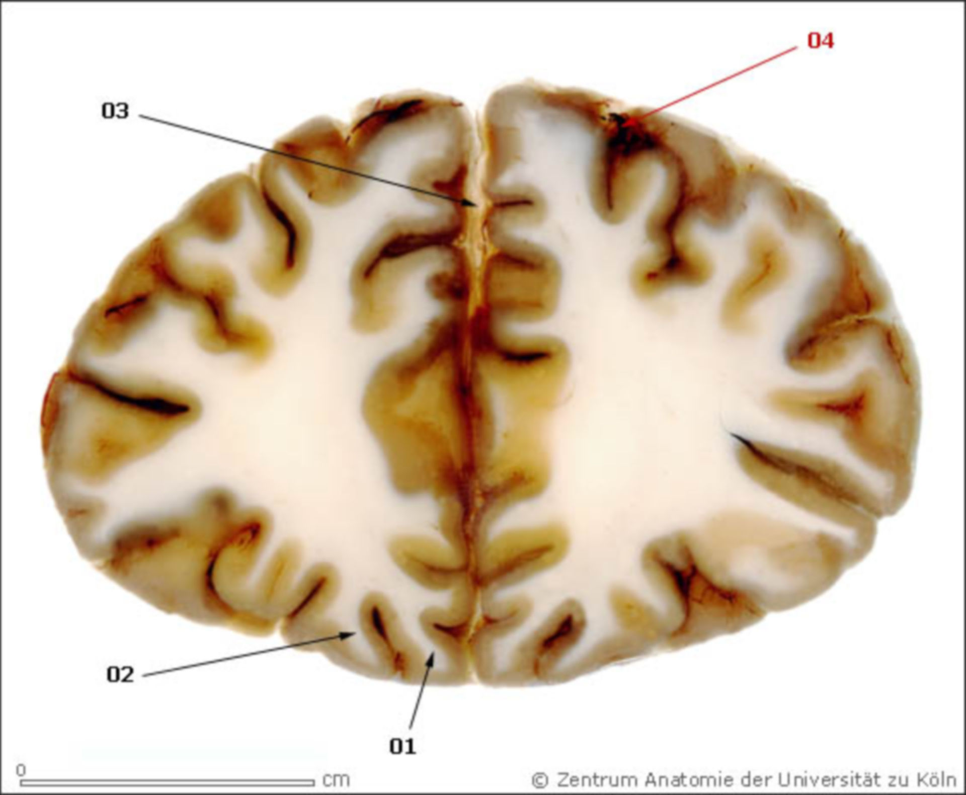Gehirn - Schnittbild 4 (rostral nach posterior)