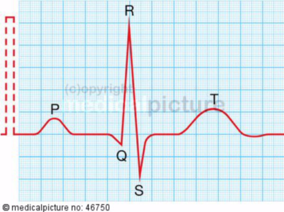 EKG, Sinusrhythmus
