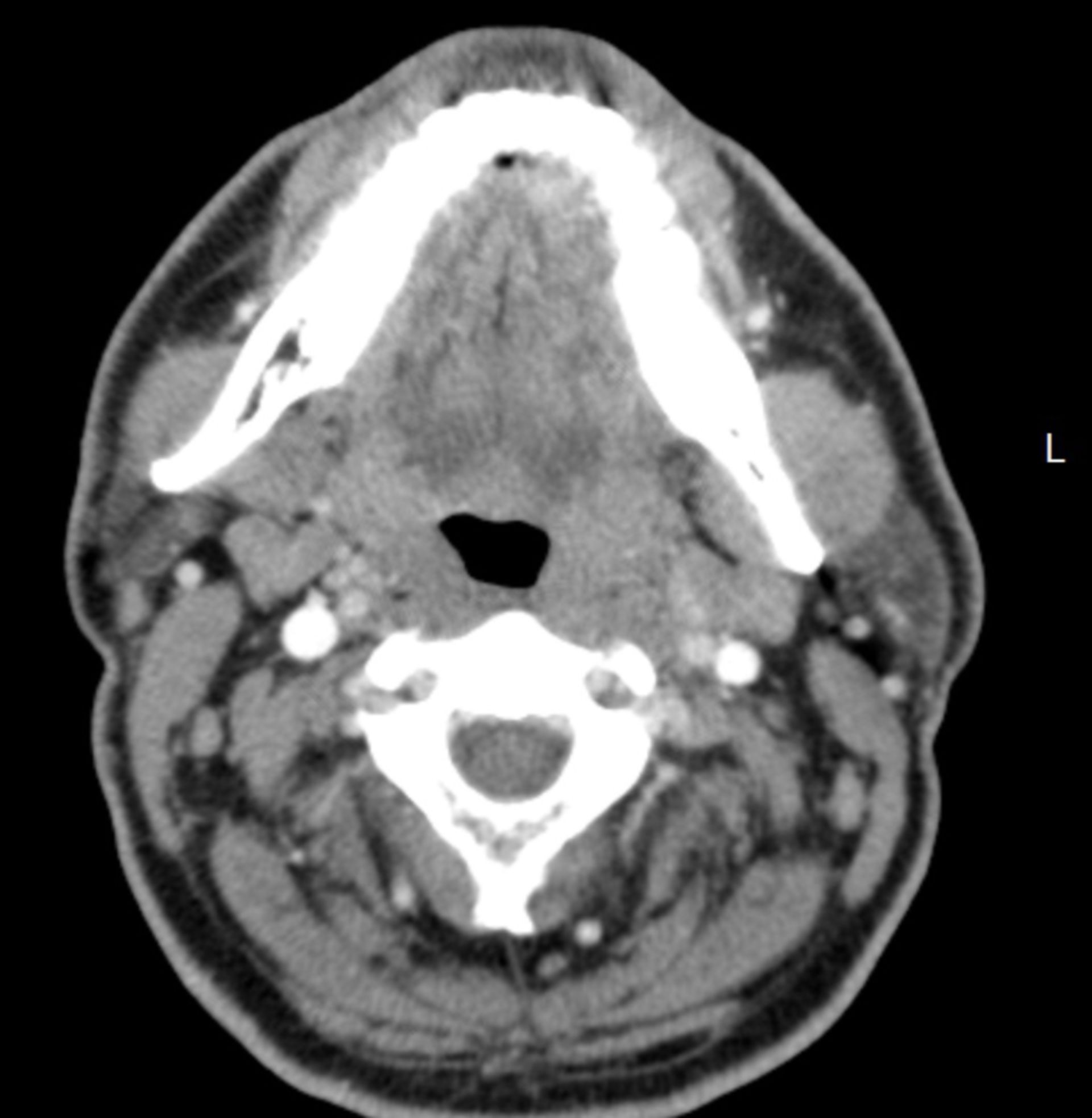 ct_tra2: CT des Kopfes in transversaler Ebene
