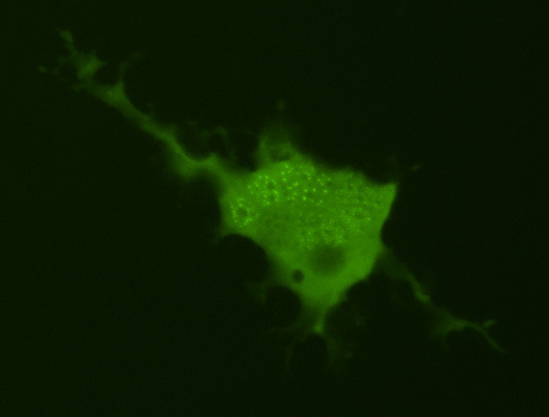 Menschliche Zellen mit einer großen Menge an FE65 enthalten im Zellkern kugelige Strukturen, sogenannte nukleare Sphären. © RUB, Bild: Müller