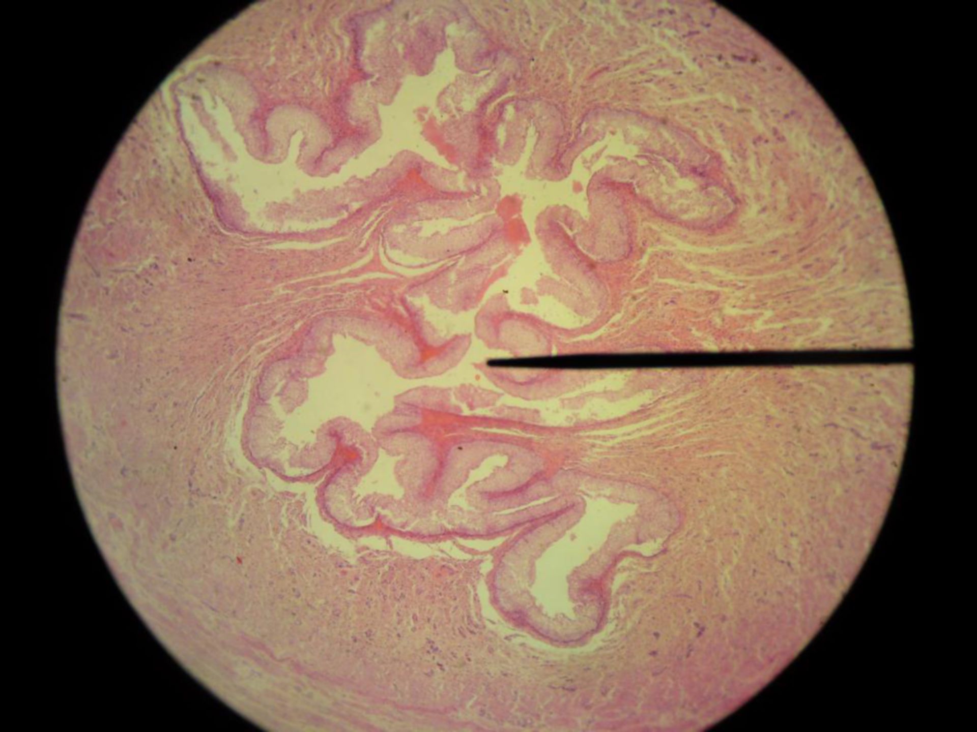 Transitional epithelium (ureter horse)