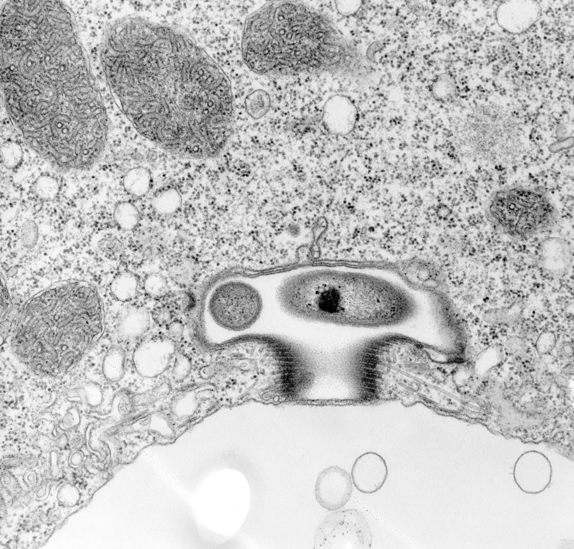 Vorticella convallaria (Symbiont-containing vacuolar space) - CIL:39505