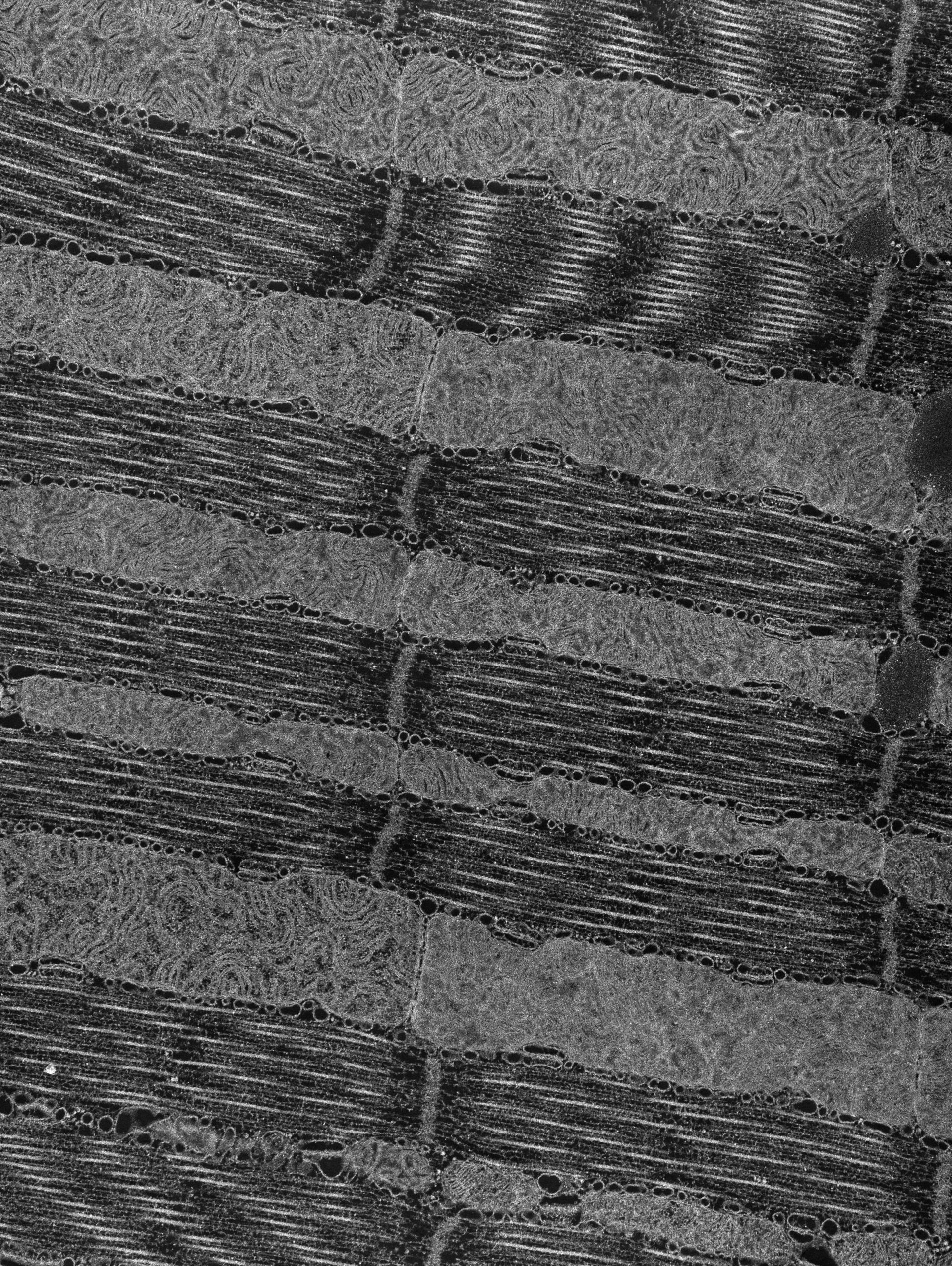 Damselfly (T-tubule) - CIL:36118