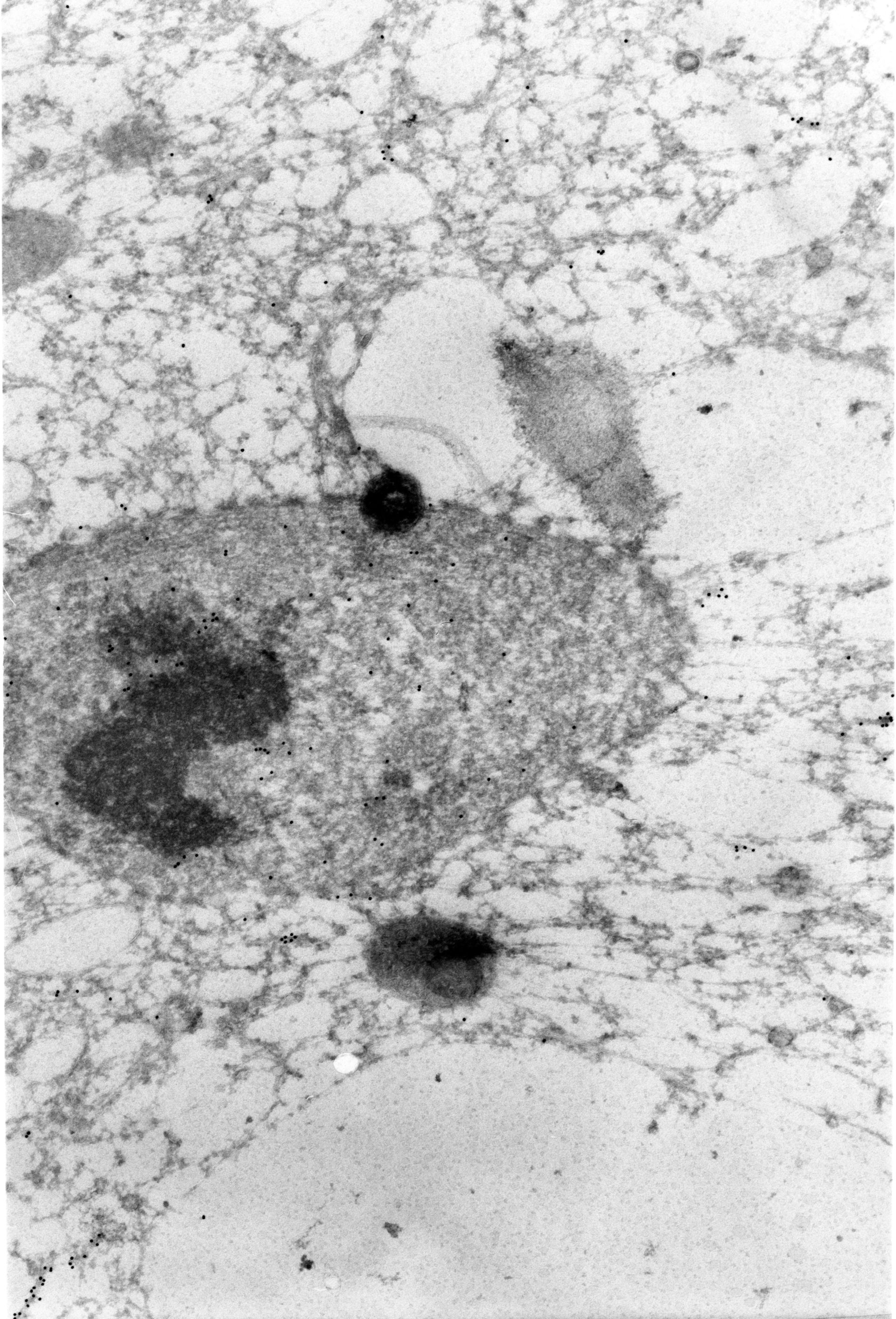 Paramecium tetraurelia (microtubuli citoplasmatica) - CIL:1311