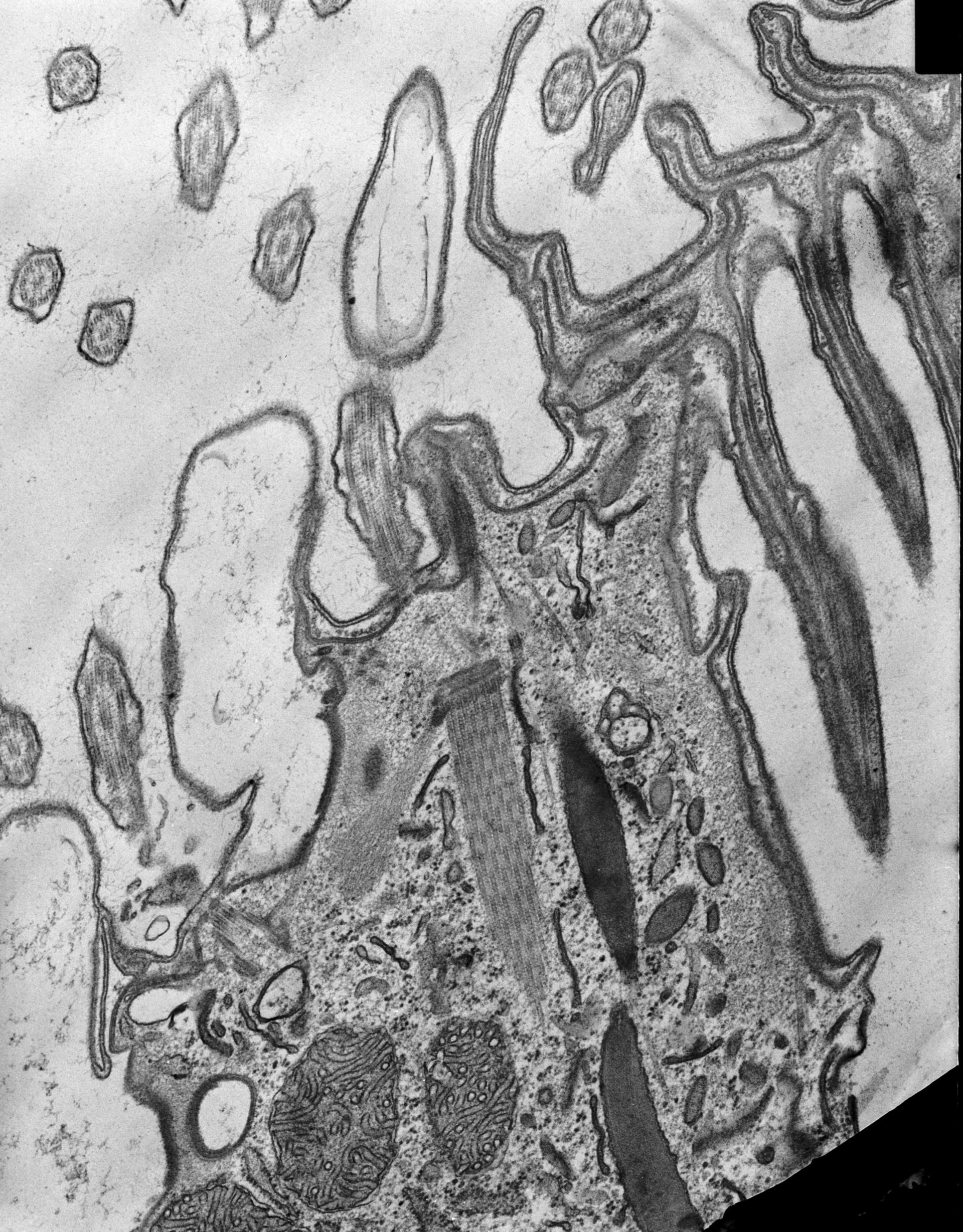 Coleps hirtus (Actin cytoskeleton) - CIL:9018