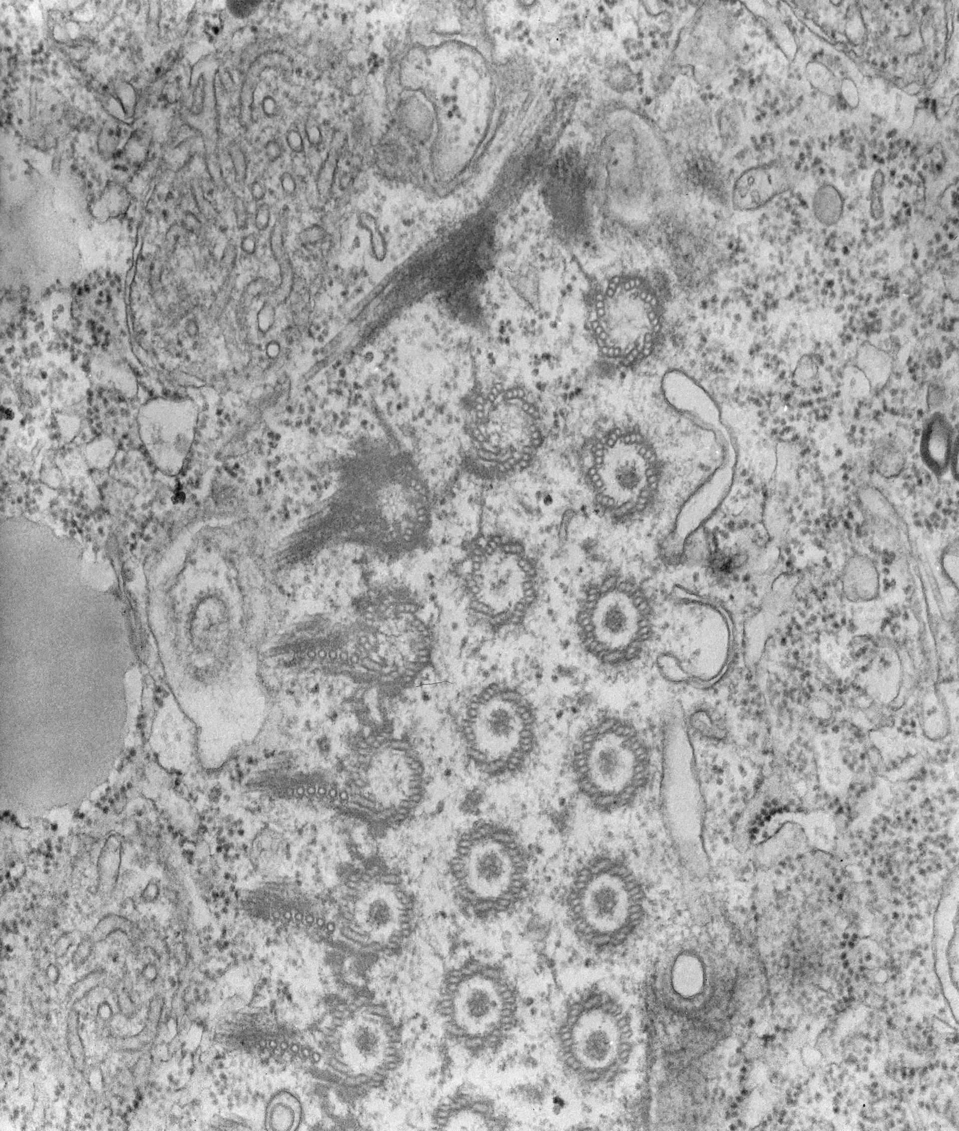 Tetrahymena pyriformis (Oral apparatus) - CIL:39716