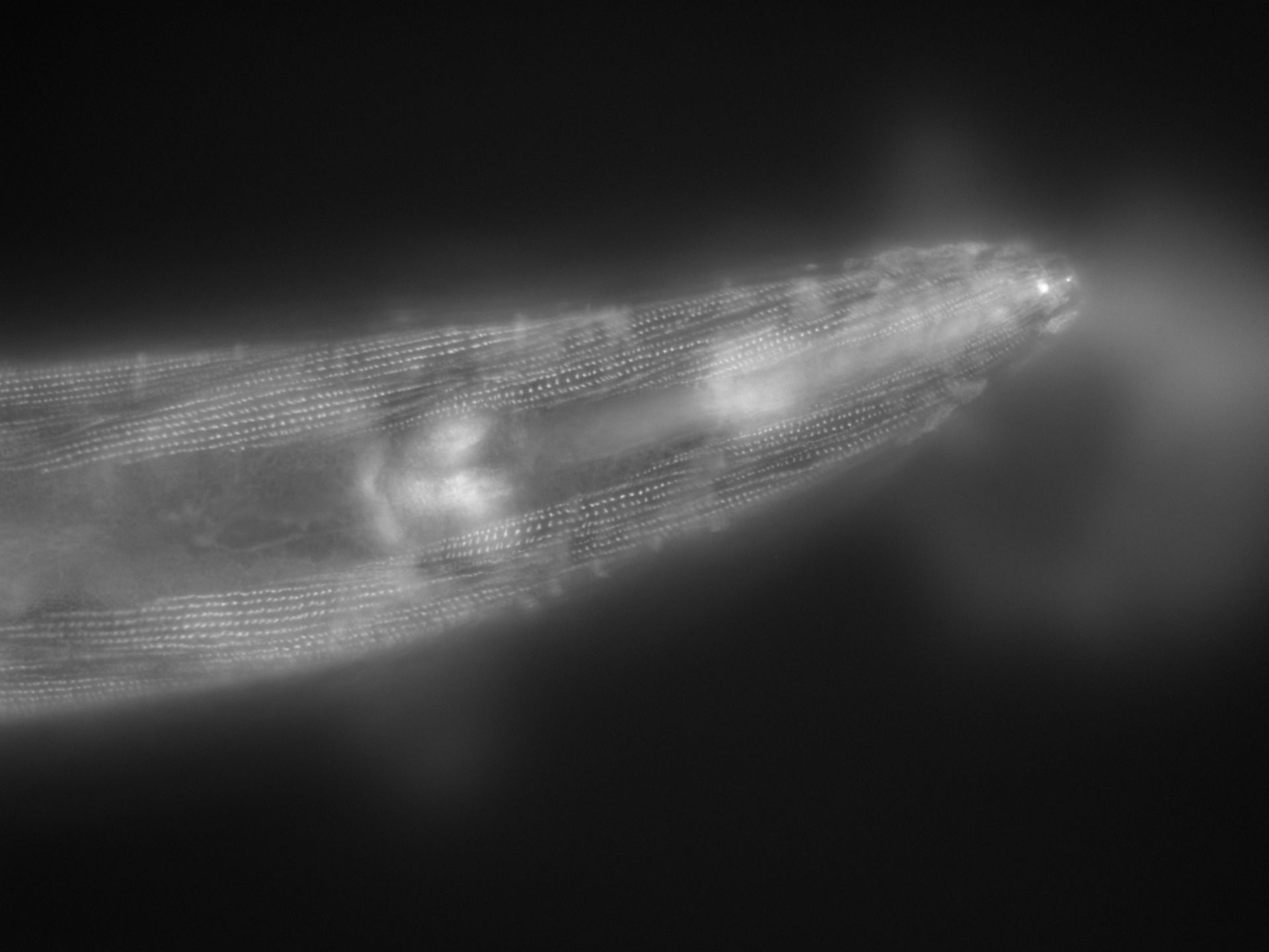 Caenorhabditis elegans (Actin filament) - CIL:1161