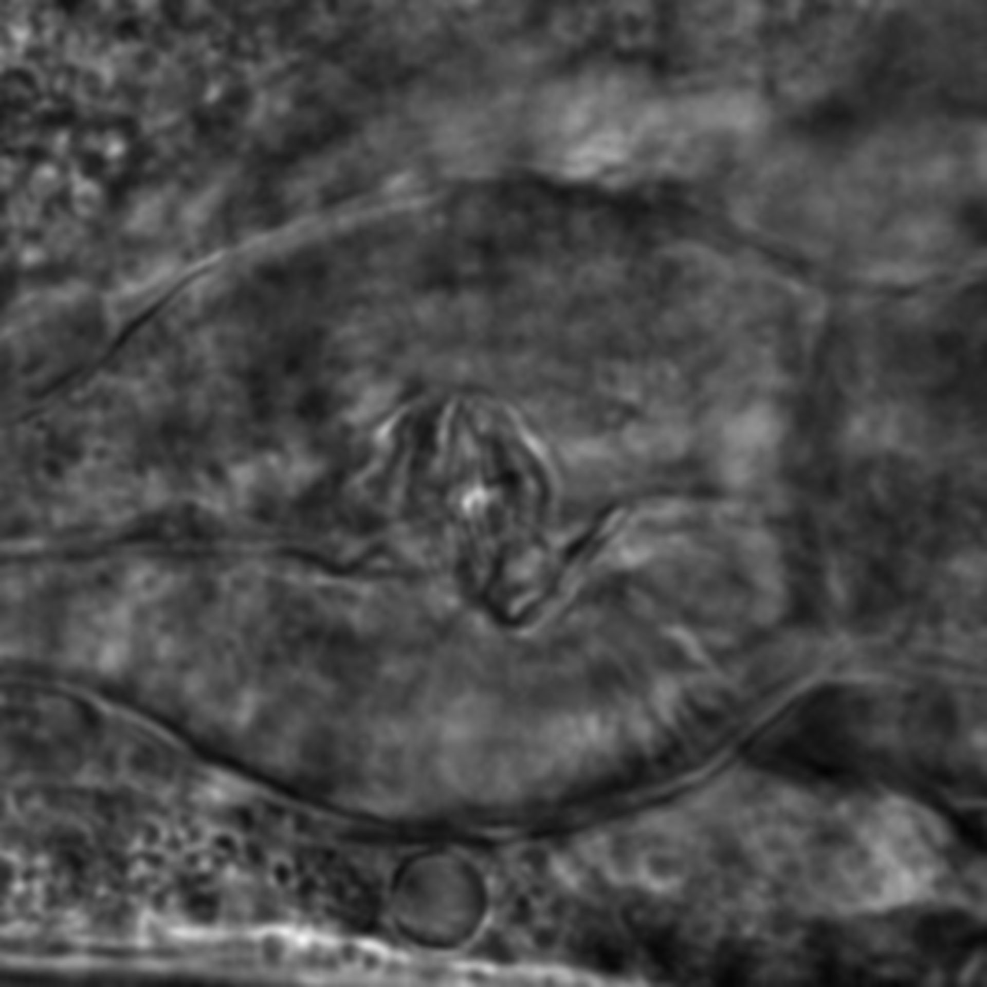 Caenorhabditis elegans - CIL:2753
