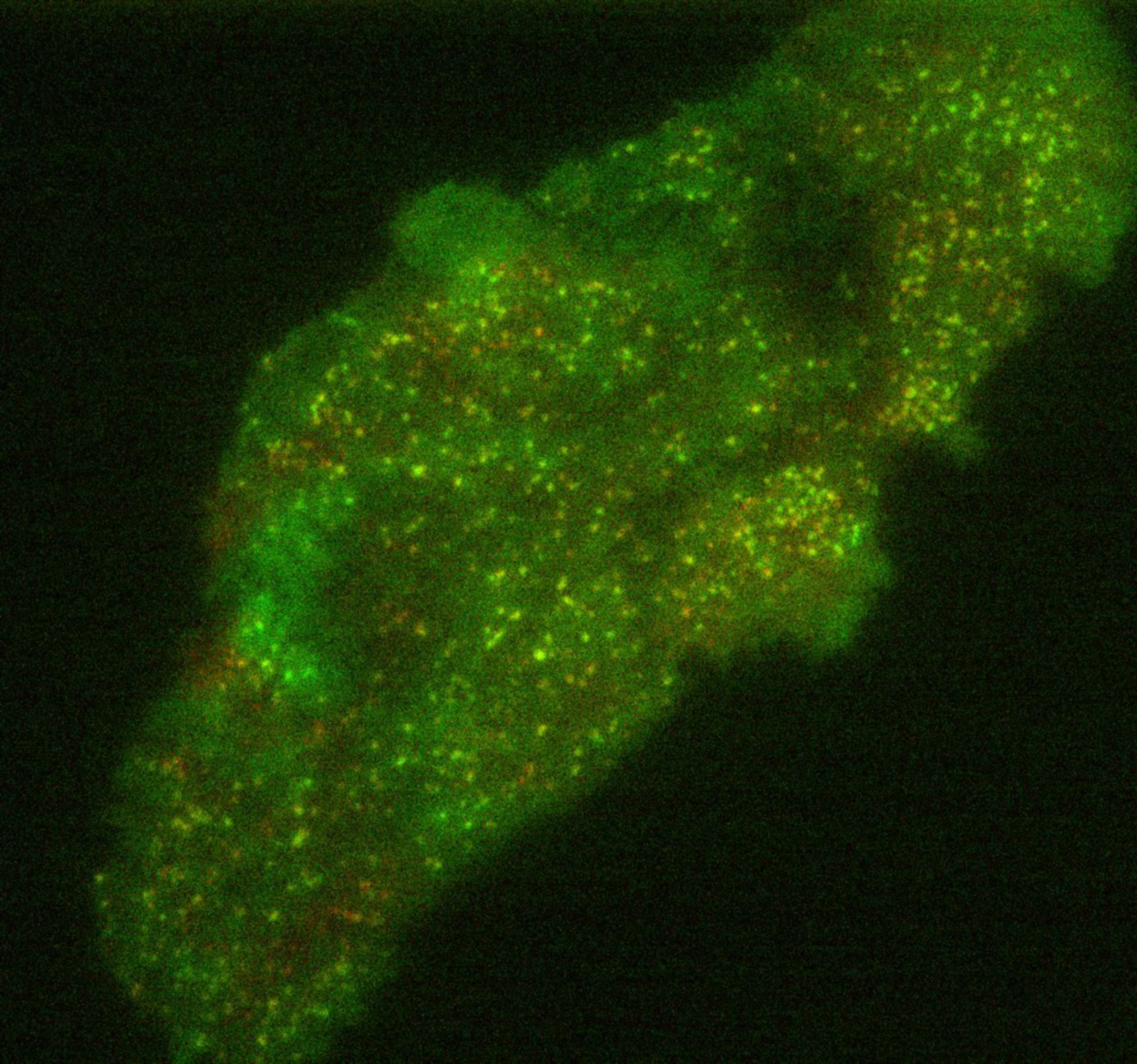 Homo sapiens (Clathrin light chain) - CIL:10101