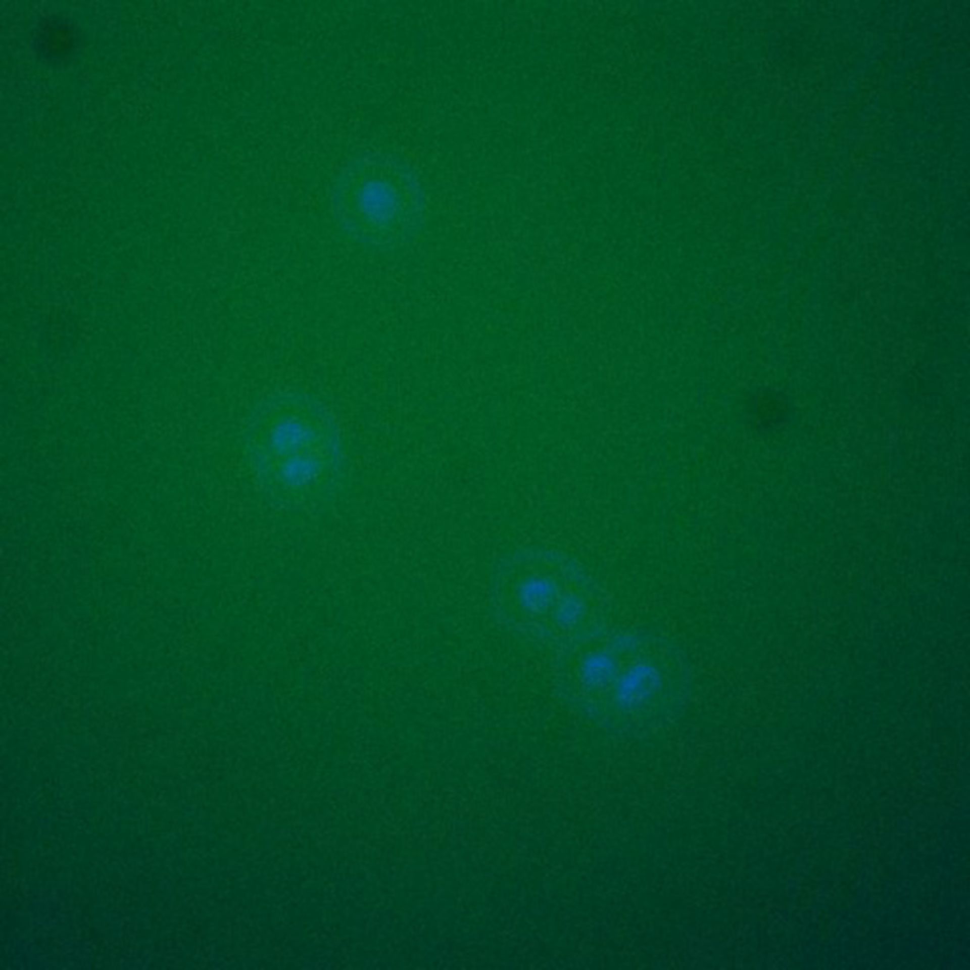 Saccharomyces cerevisiae (Spindle pole body) - CIL:39578