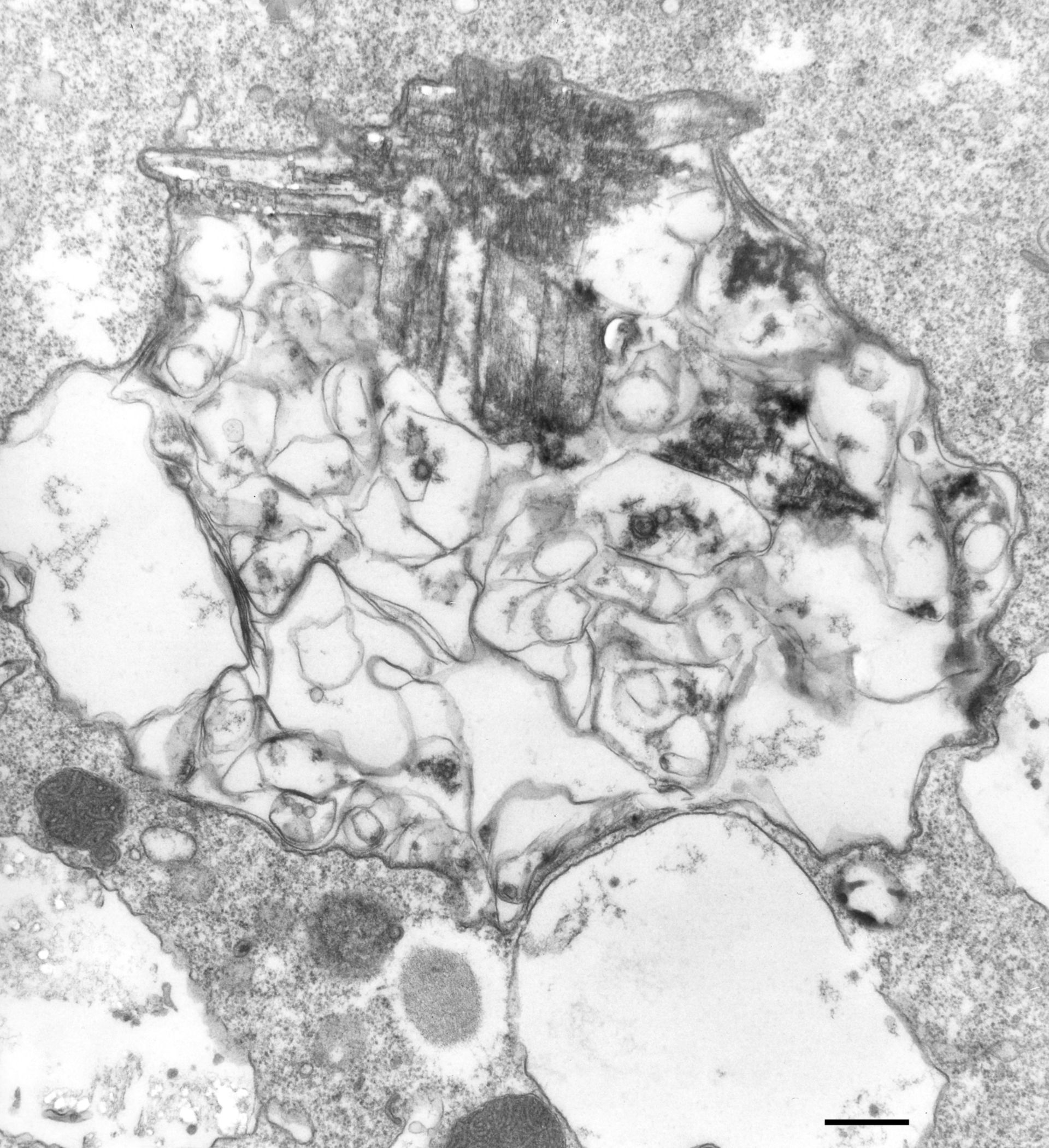 Paramecium multimicronucleatum (Cytoplasm) - CIL:36640