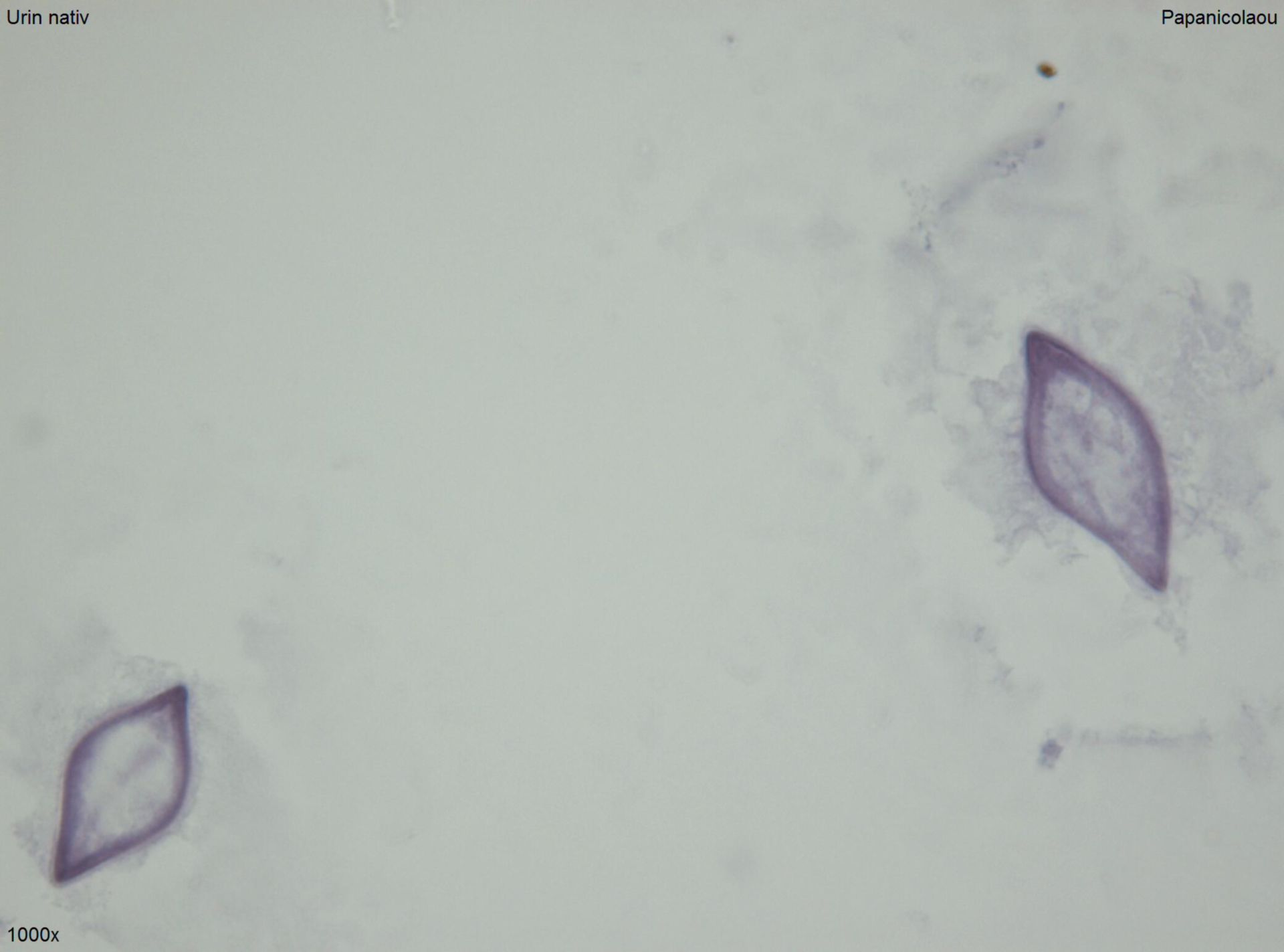 Schistosomeneier oder Pollen 4