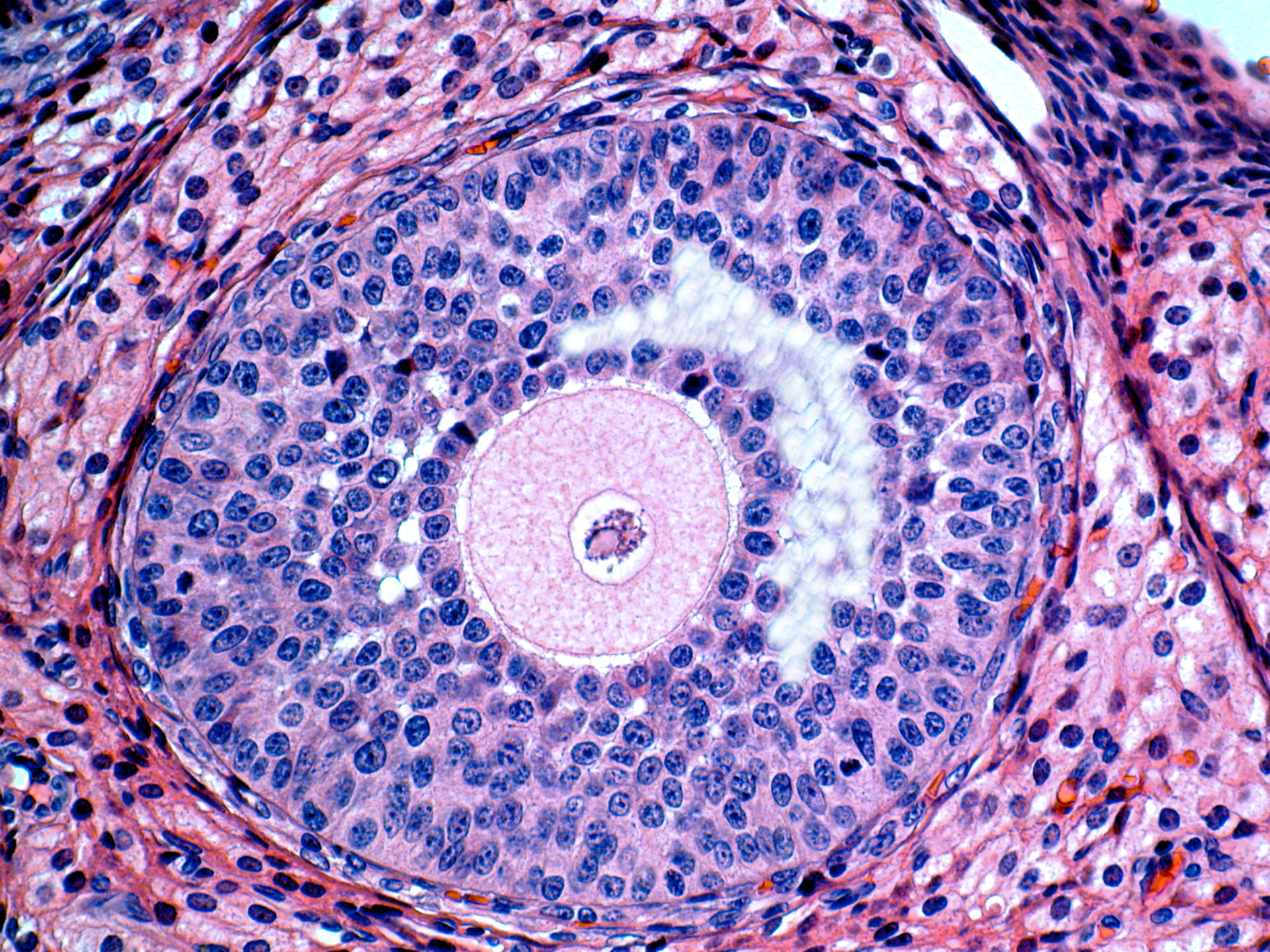 Follicle - Ovary