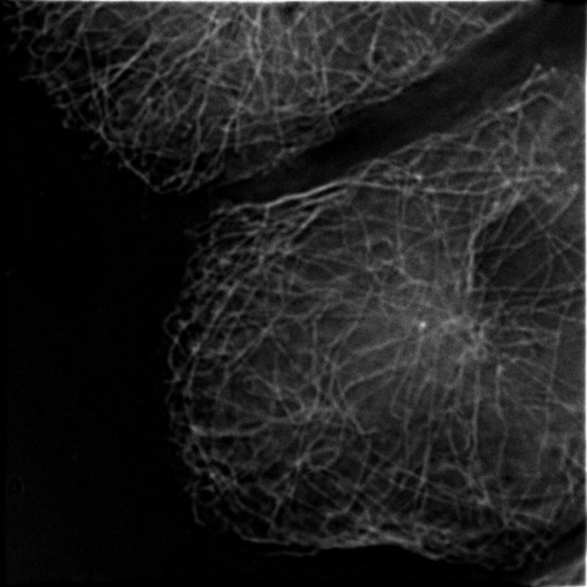 Rattus rattus (Cytoplasmic microtubule) - CIL:35281