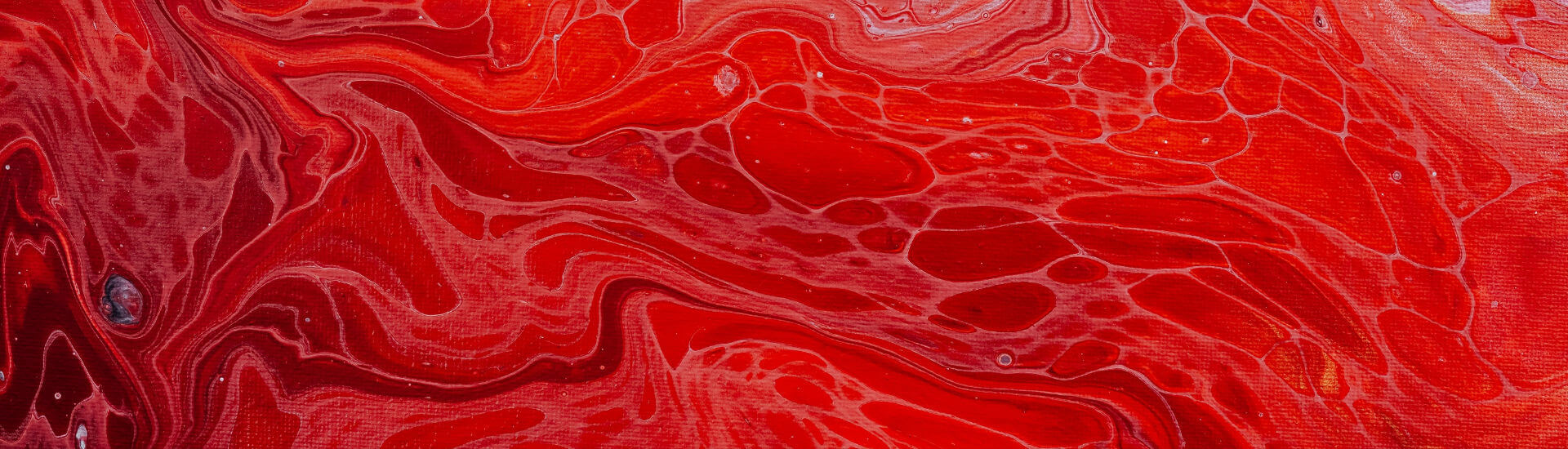 Kann Man Hautkrebs Im Blut Feststellen www.doccheck.com