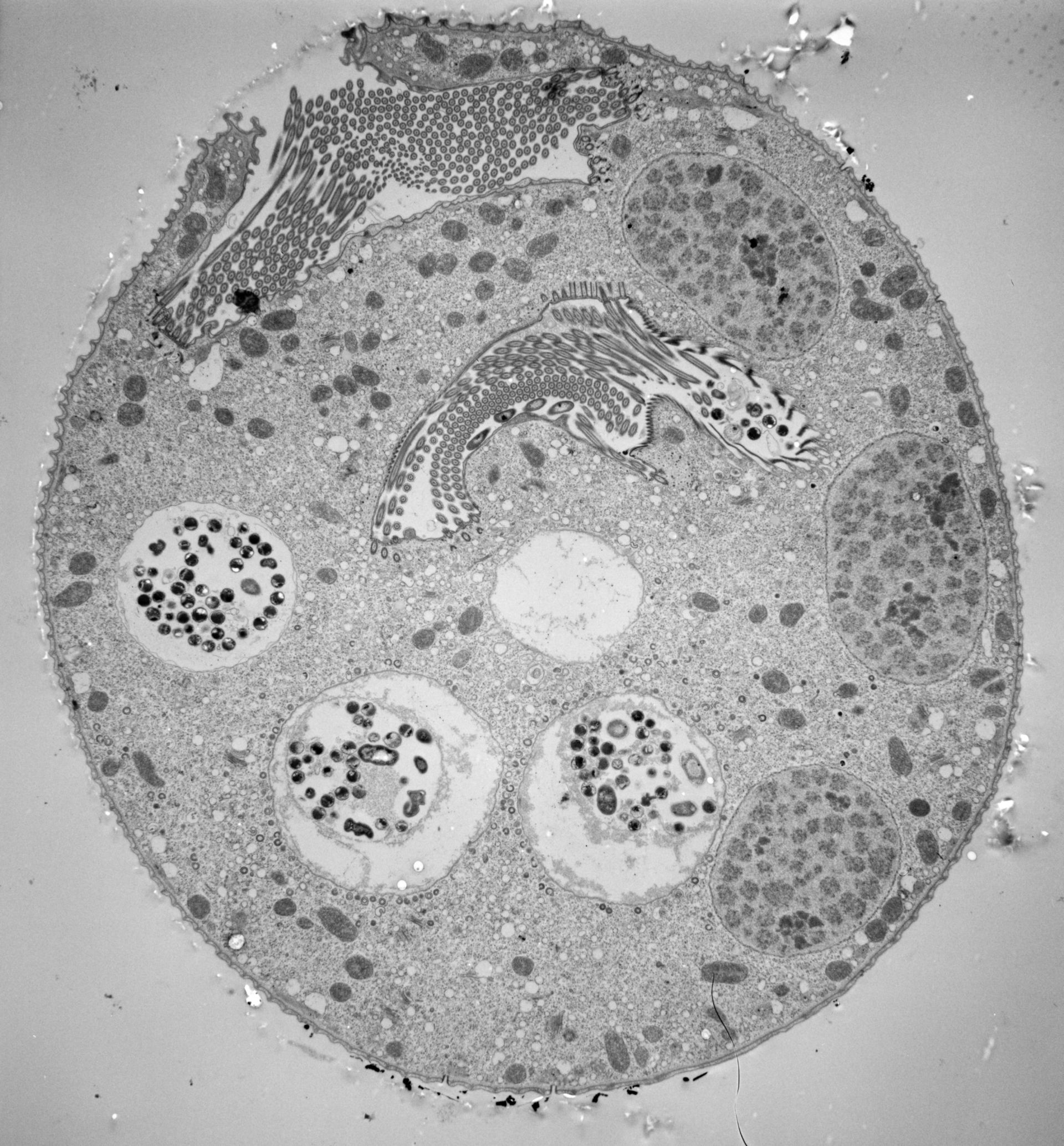 Vorticella convallaria - CIL:39403