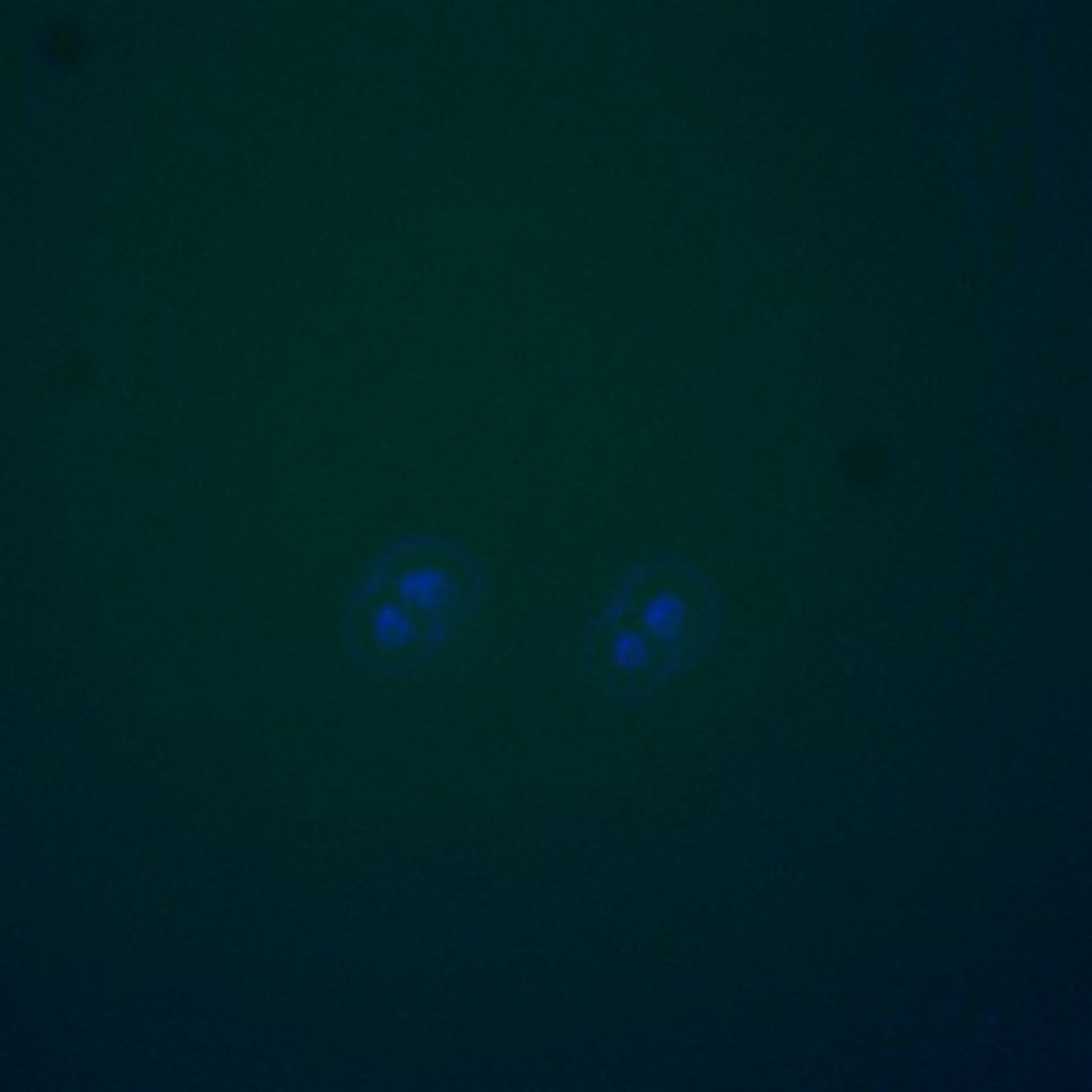 Saccharomyces cerevisiae (Spindle pole body) - CIL:39577