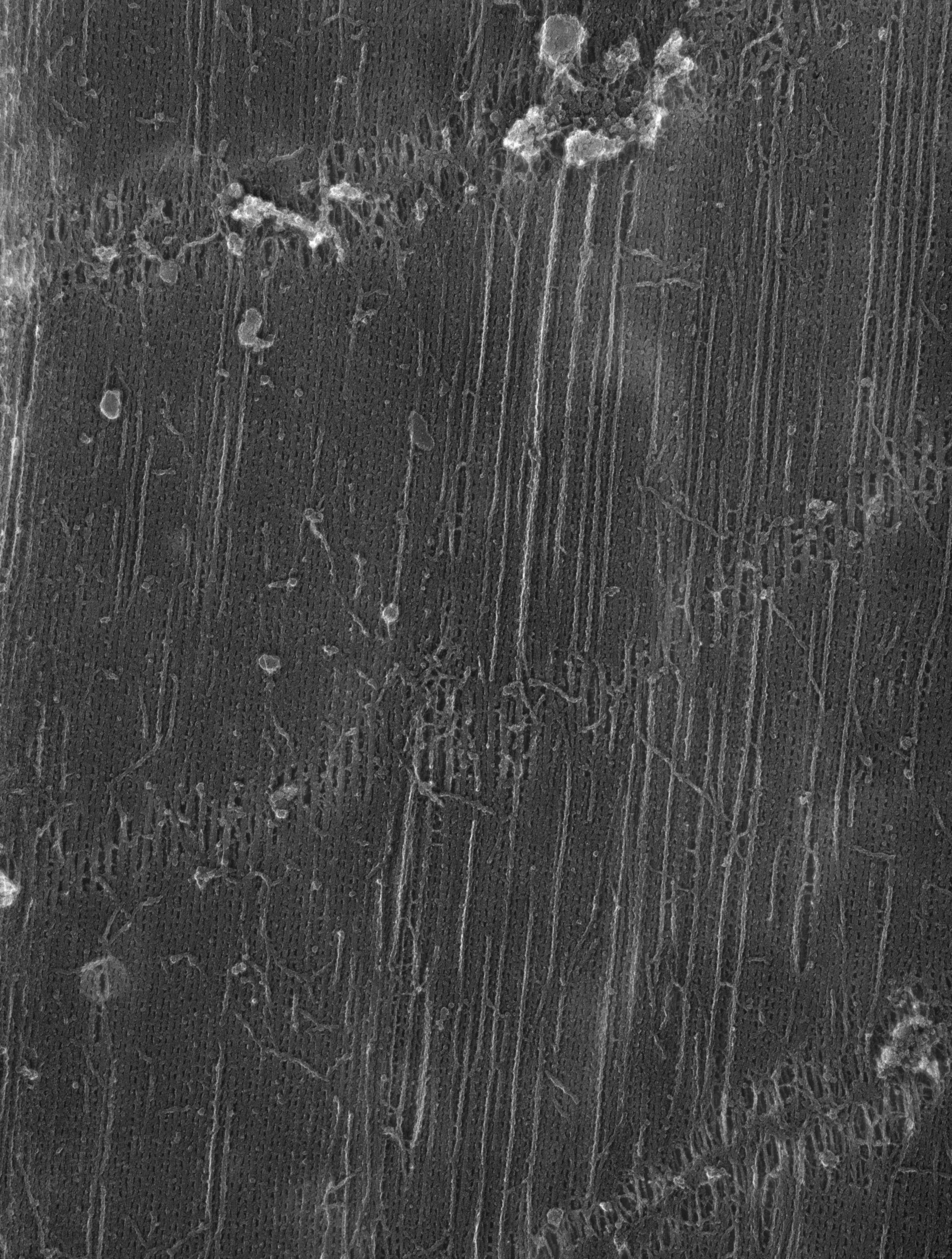 Damselfly (Sarcoplasmic reticulum) - CIL:36104