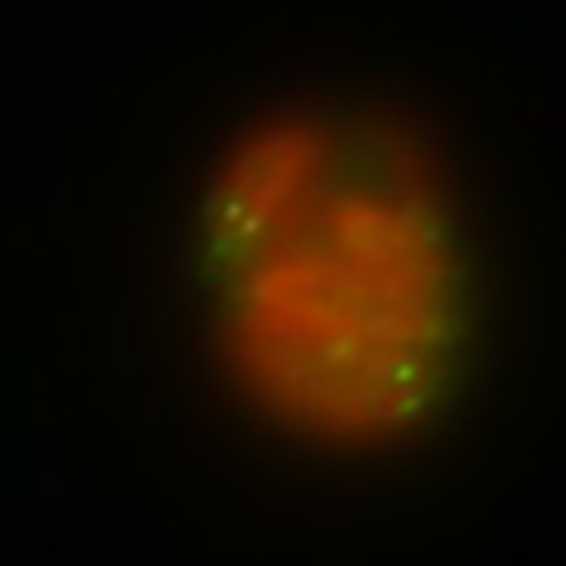 Toxoplasma gondii RH (Polar ring of apical complex) - CIL:10502