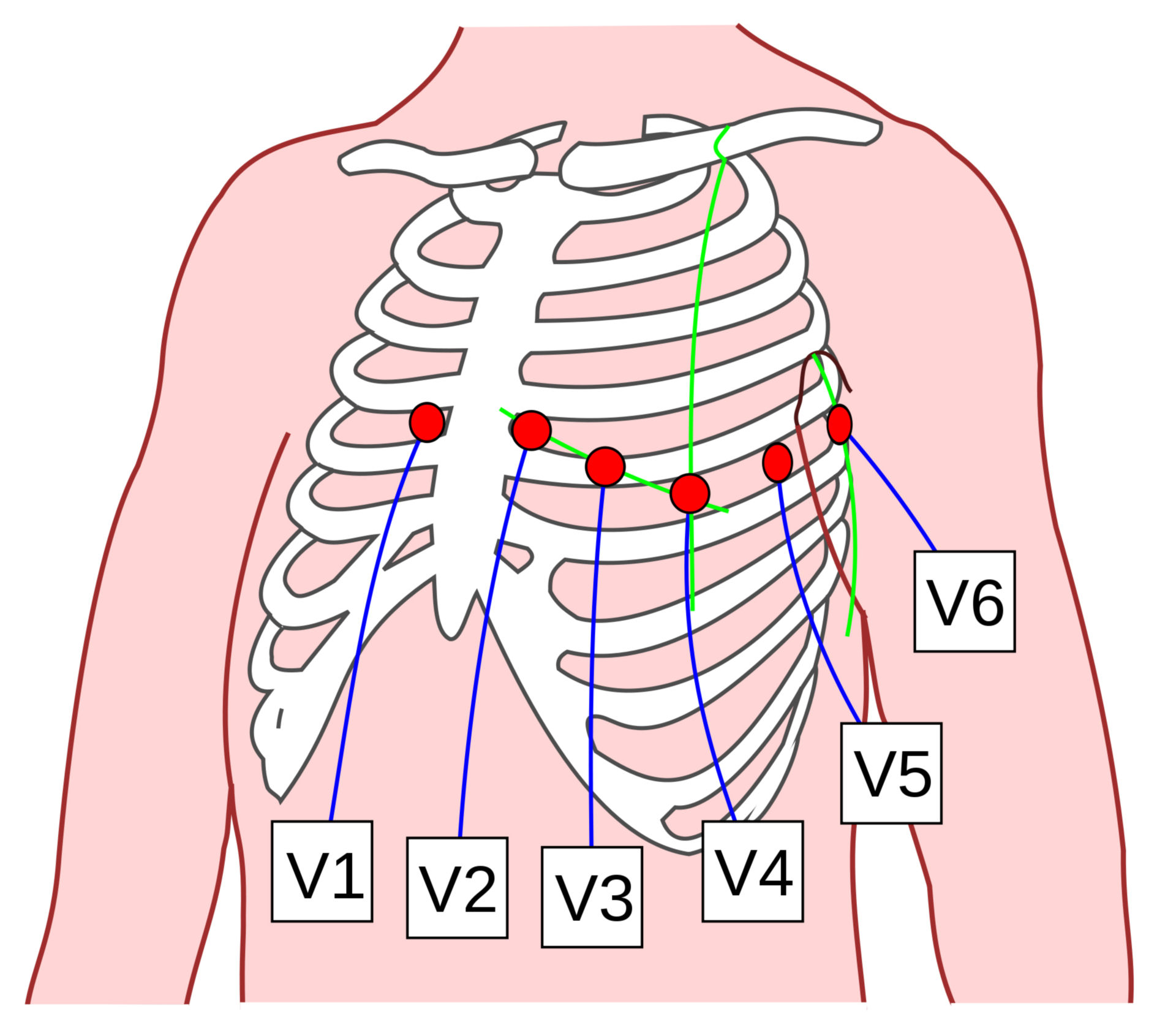 Precordial ECG leads after Wilson