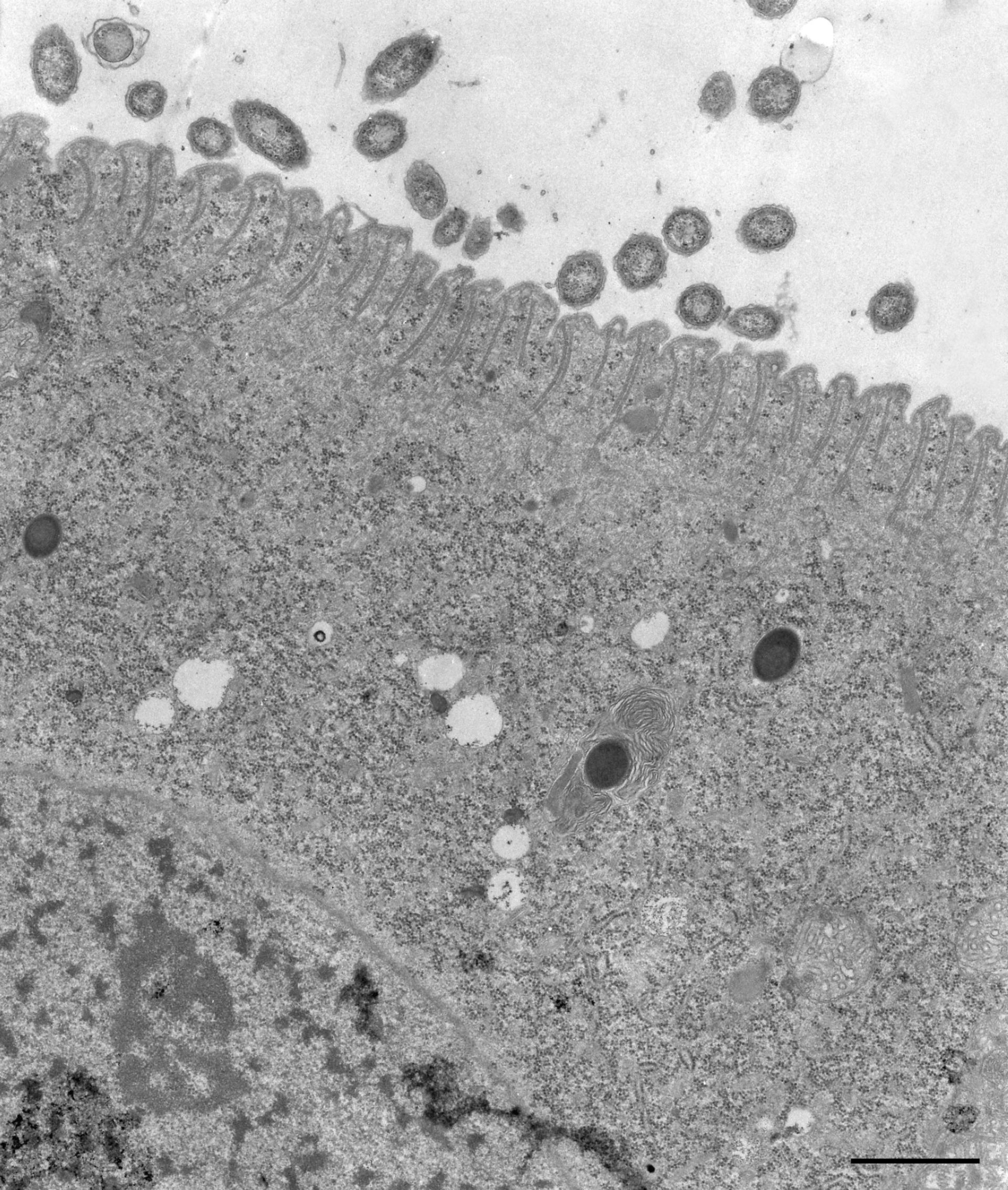 Didinium nasutum (Extrusomes) - CIL:12302