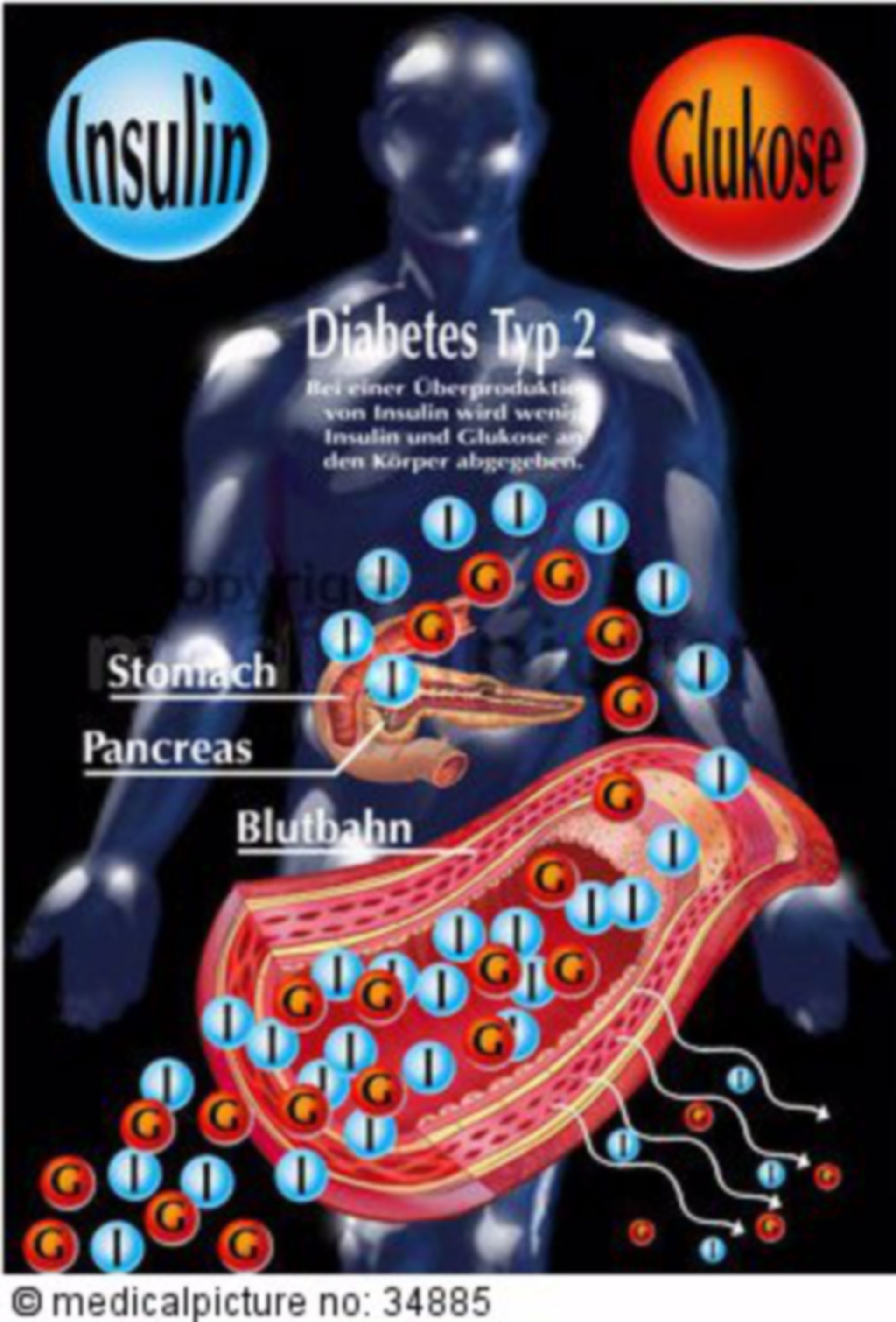Insulin secretion of people with Diabetes mellitus type 2