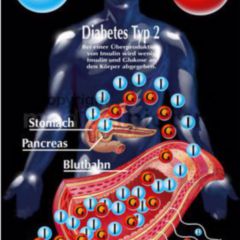 A diabetes mellitus cikk patogenezise