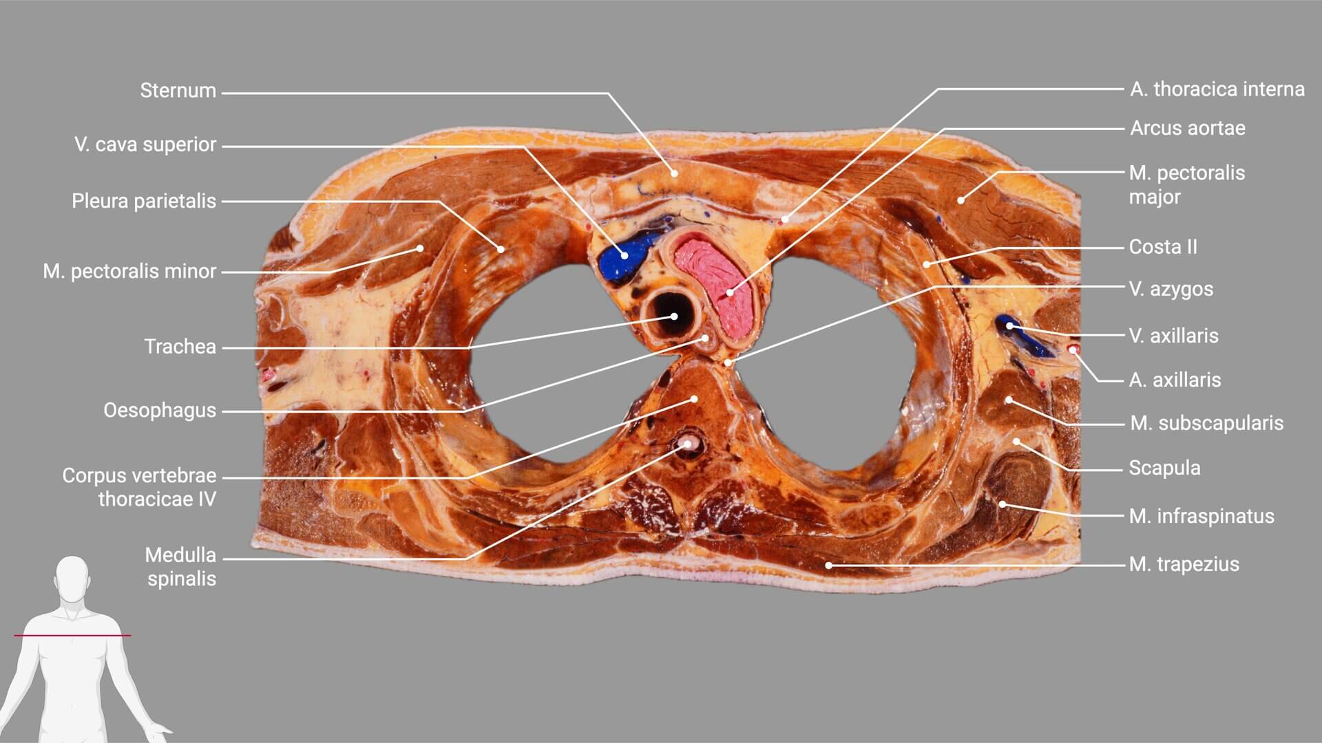 Thoraxpräparat mit Beschriftung