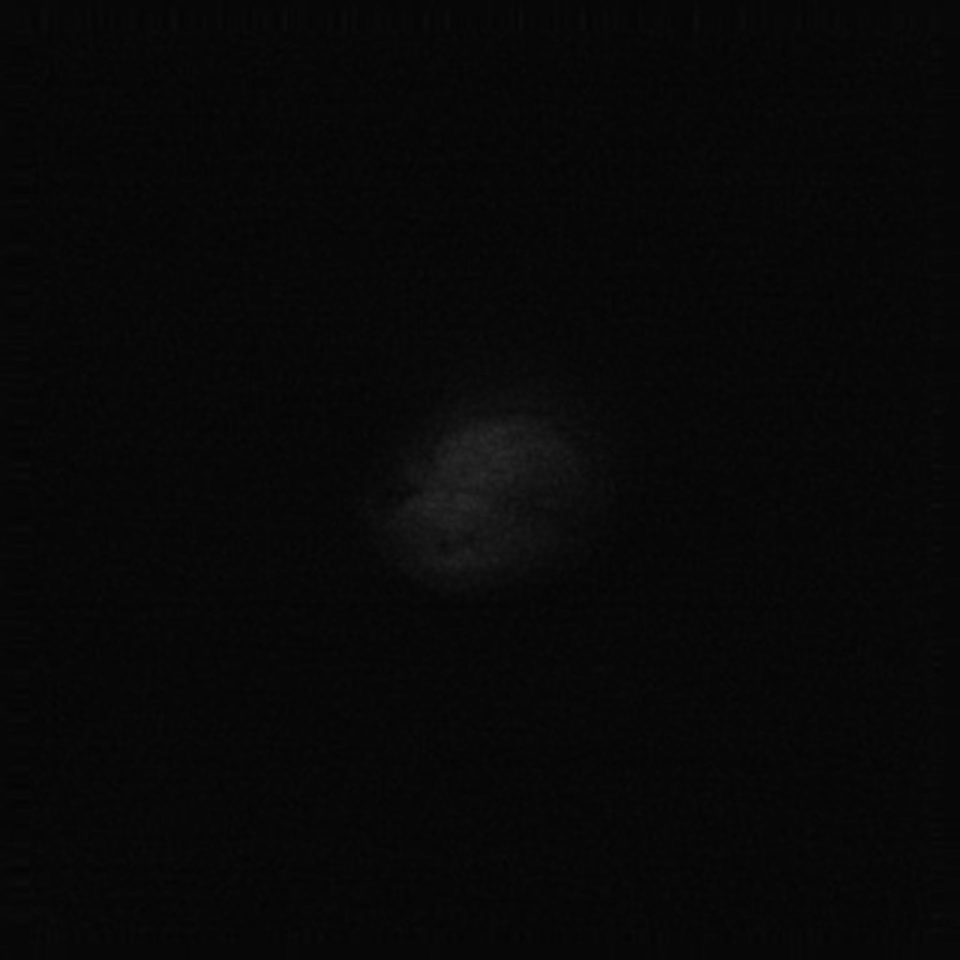 Toxoplasma gondii (Microtubule cytoskeleton) - CIL:10527