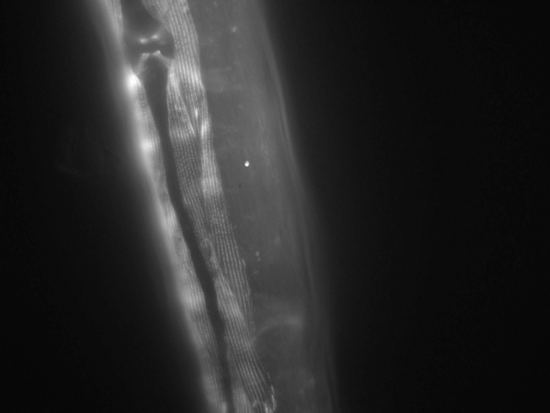 Caenorhabditis elegans (Actin filament) - CIL:1010